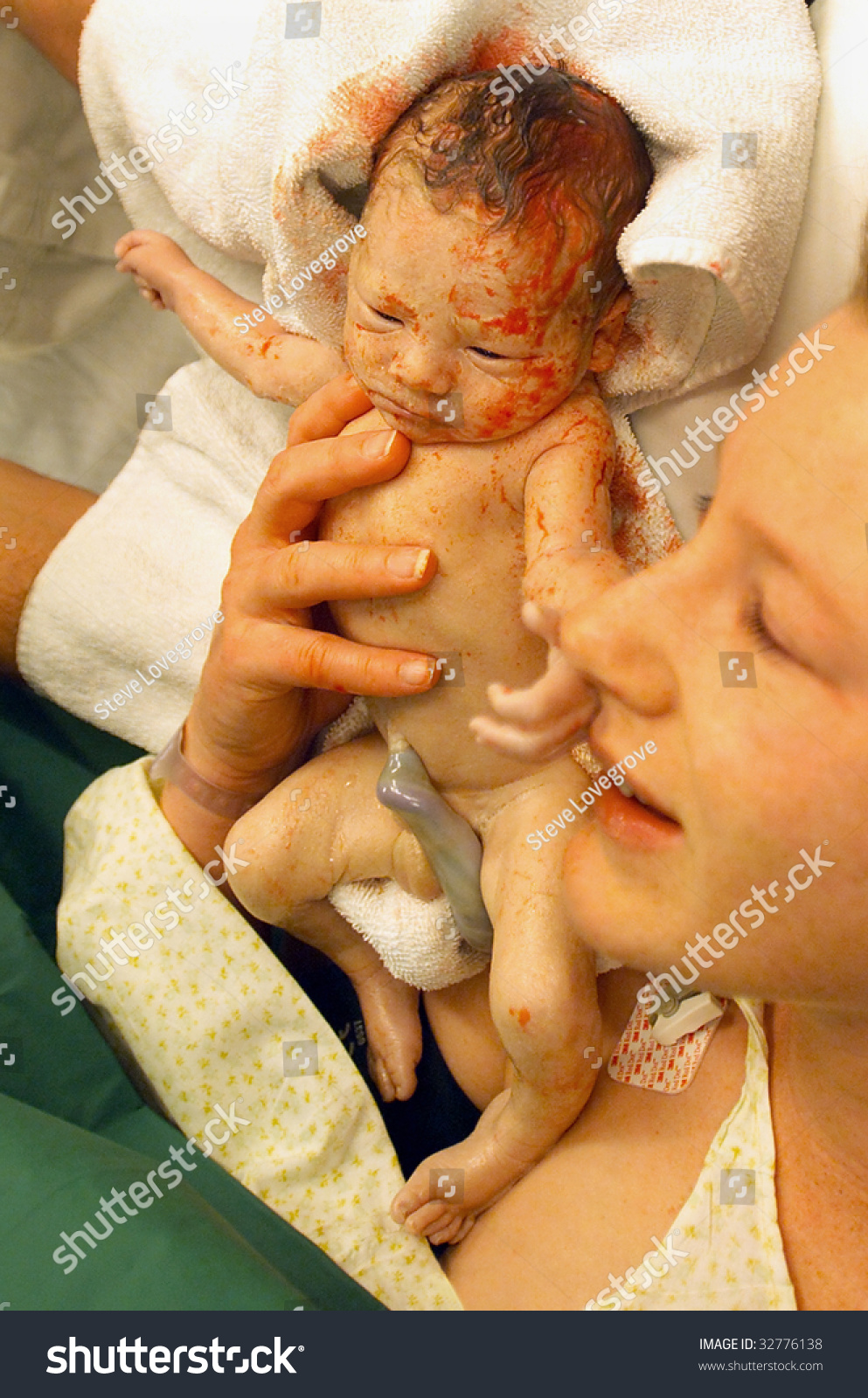 Premature Baby Boy Delivered By Caesarean Stock Photo Edit Now 32776138