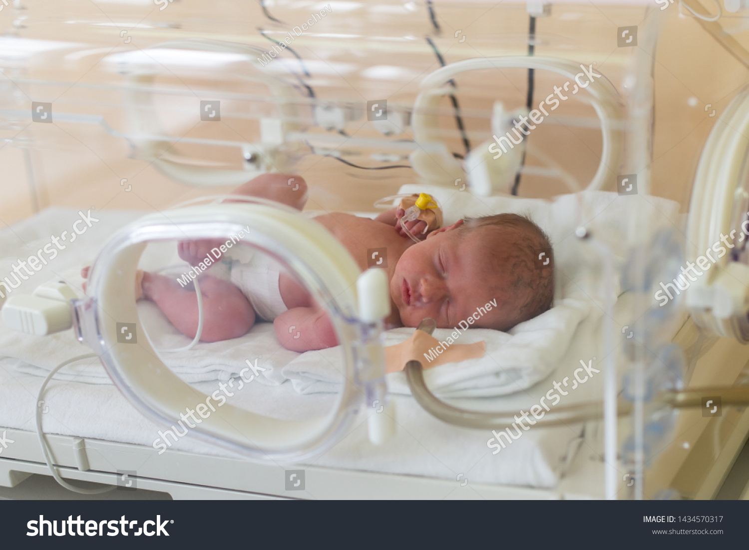 care of neonate in incubator