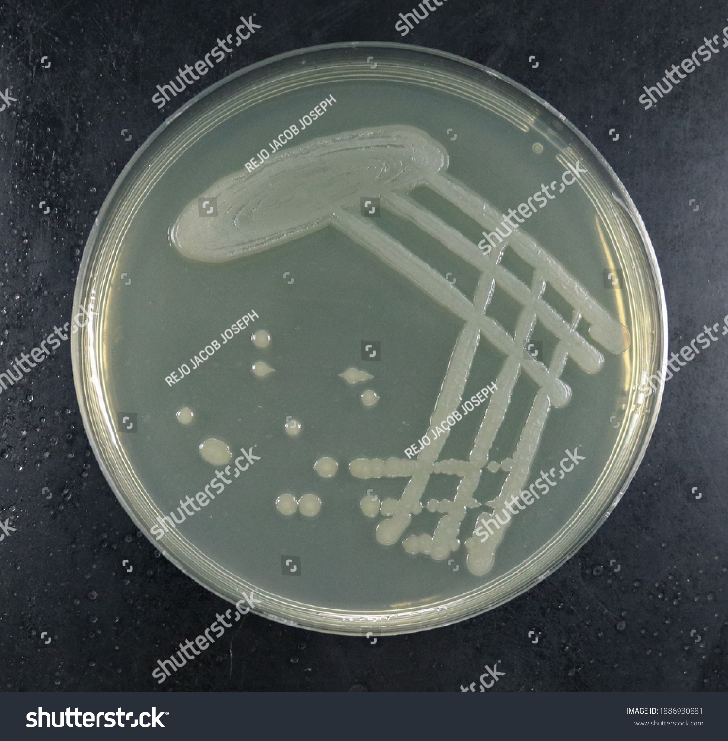 Pseudomonas Aeruginosa Colonies Nutrient Agar Stock Photo Shutterstock