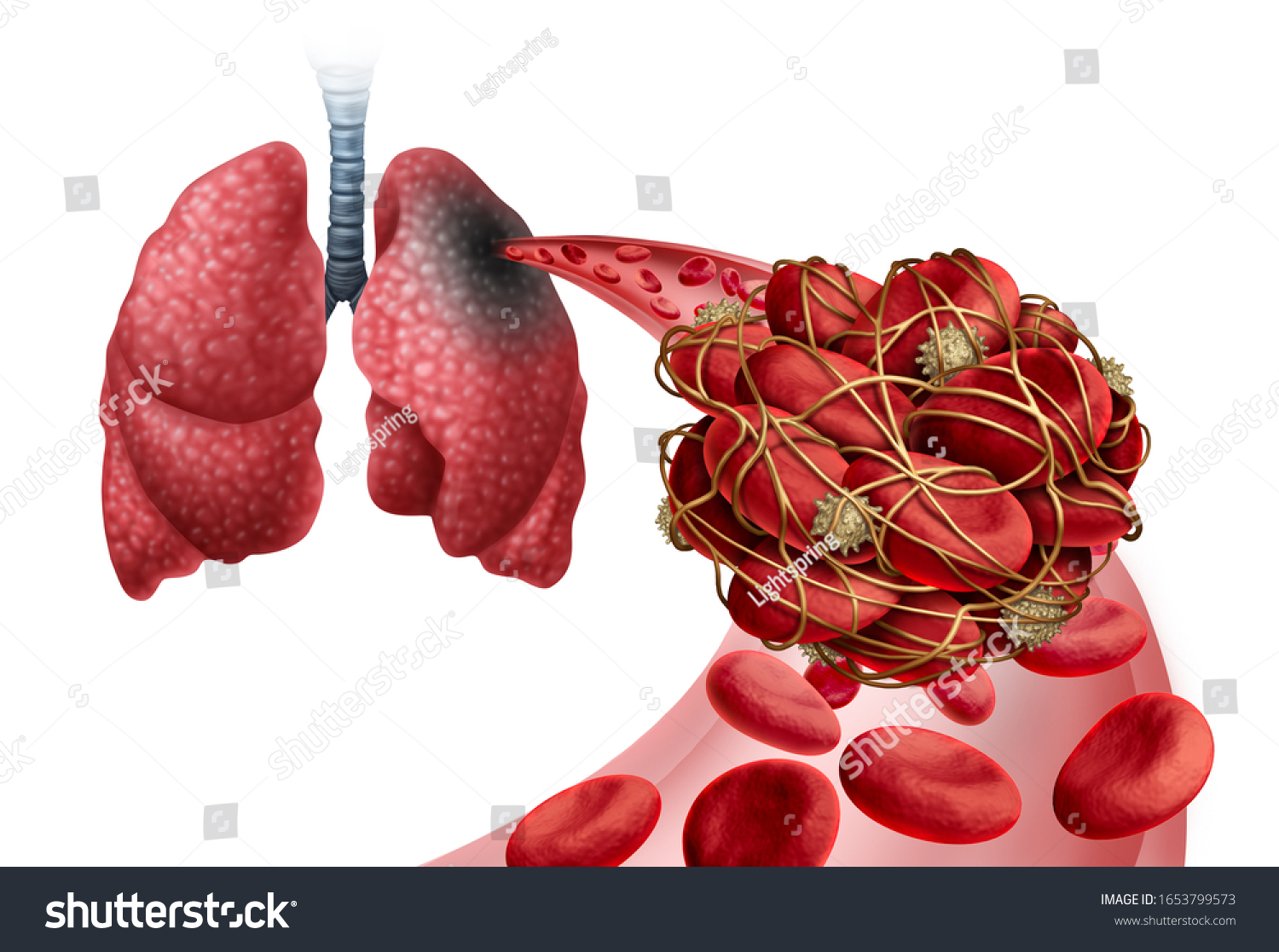 lungs-blood-images-stock-photos-vectors-shutterstock