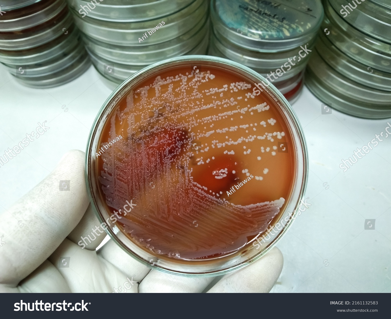 Pure Growth Staphylococcus Aureus Bacteria On Stock Photo 2161132583 ...