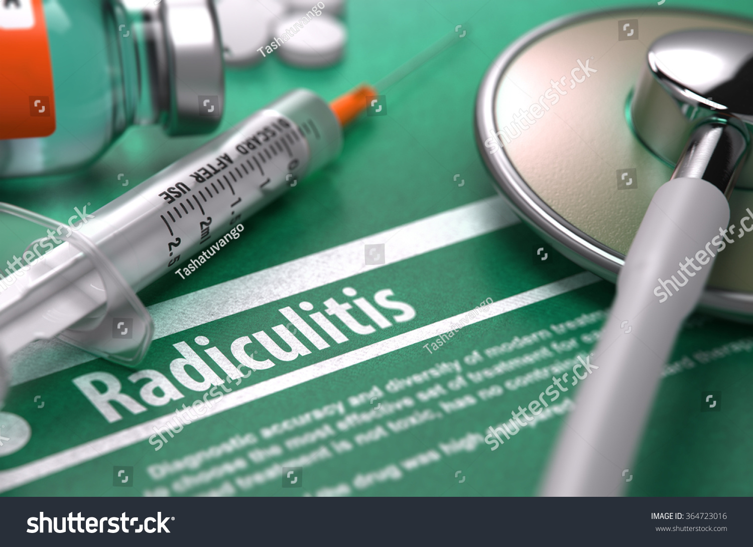 What is radiculitis, how does it differ from osteochondrosis, and how to treat it What is radiculitis, how does it differ from osteochondrosis, and how to treat it