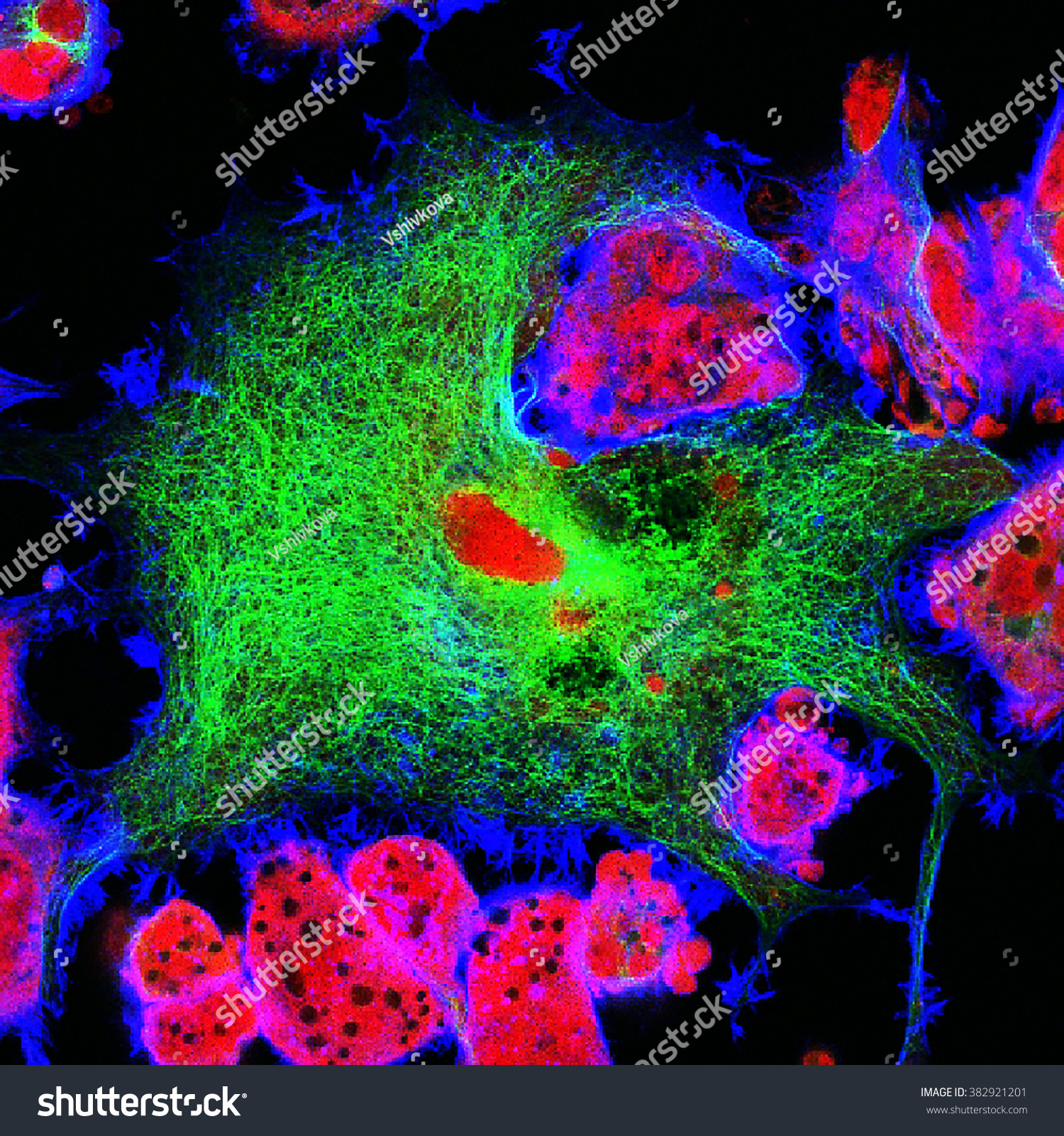 Real Fluorescence Microscopic View Human Neuroblastoma Stock Photo ...