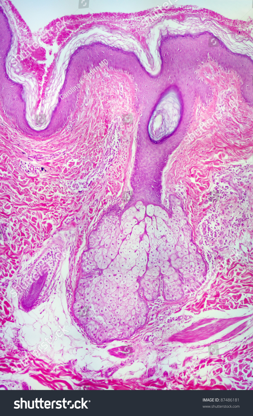 Sebaceous Gland Histology Labeled