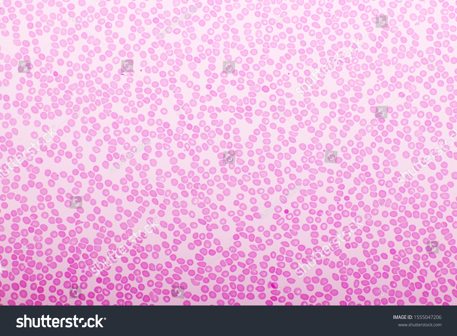 red-blood-cells-blood-smear-wrightgiemsa-stock-photo-edit-now-1555047206