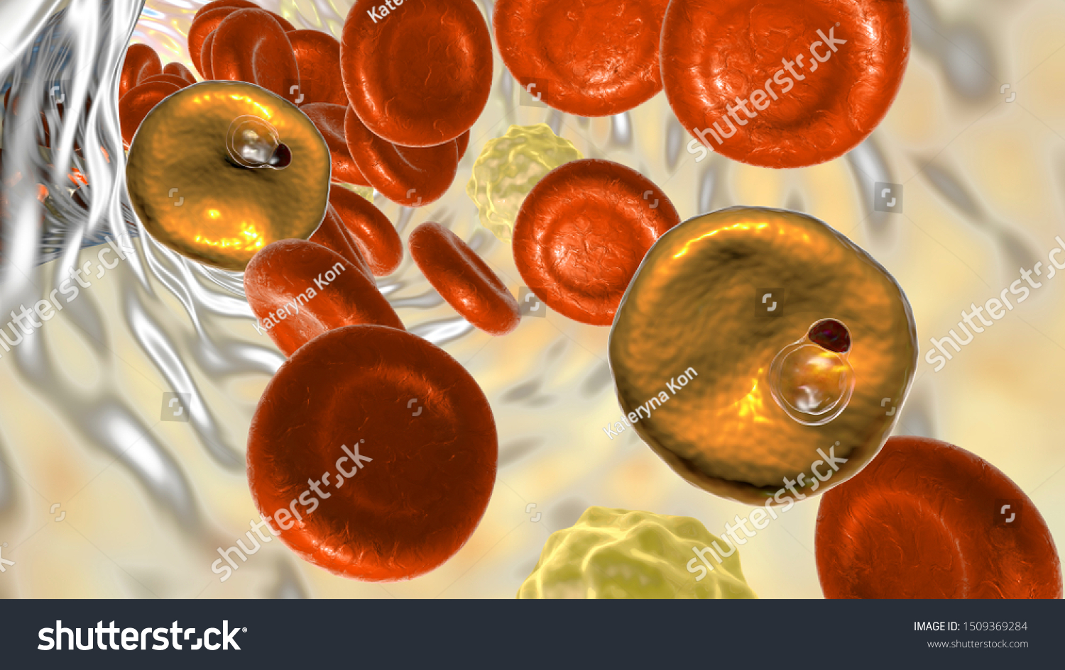 Red Blood Cells Infected Malaria Parasite Stock Illustration 1509369284 ...