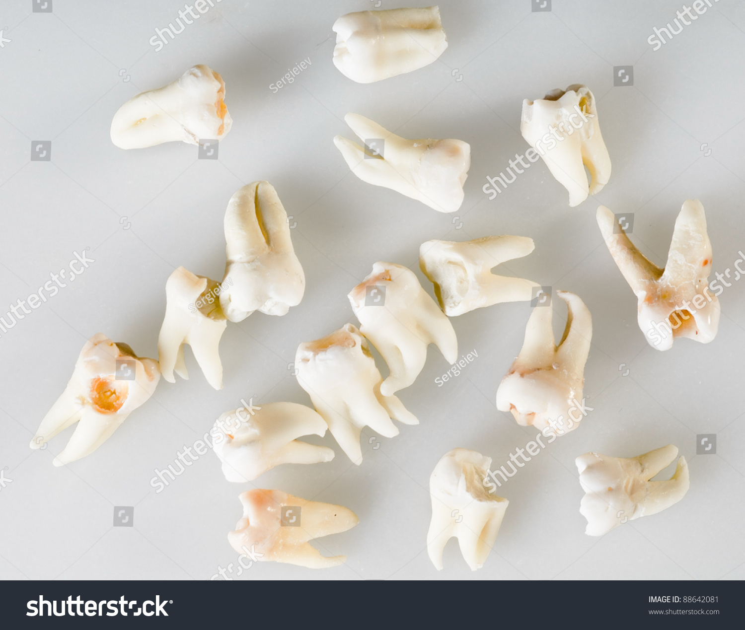 Remote Root Human Teeth With Various Defects Stock Photo 88642081 ...