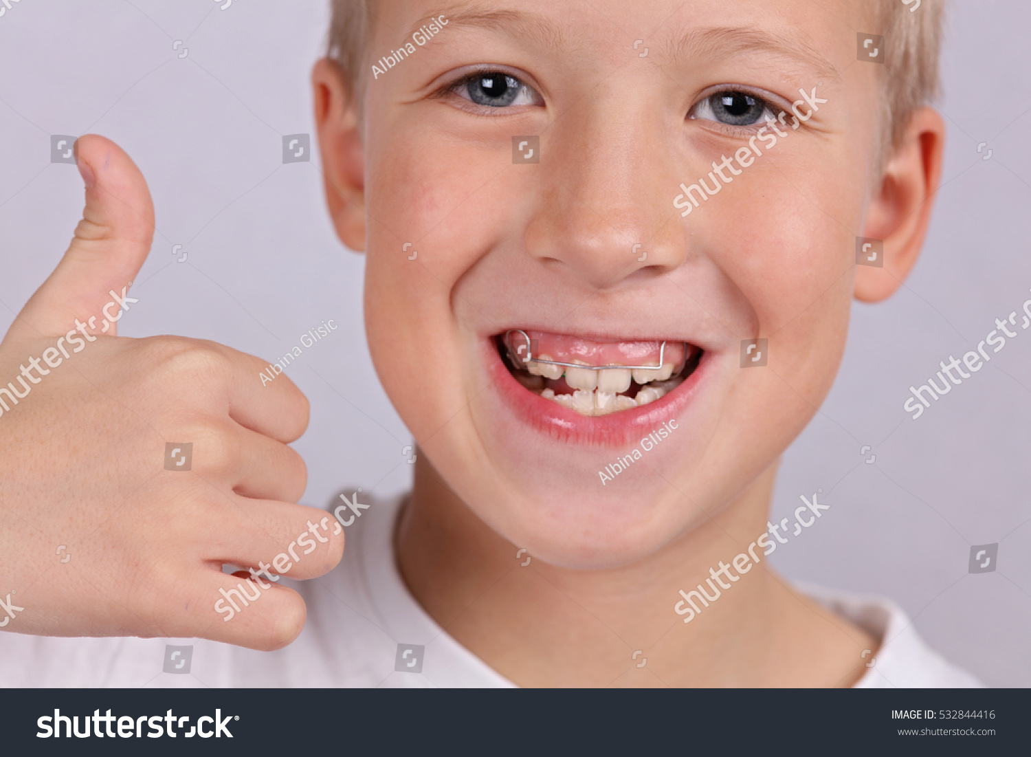 Removable Braces Children Happy Smiling Boy Stock Photo Edit Now