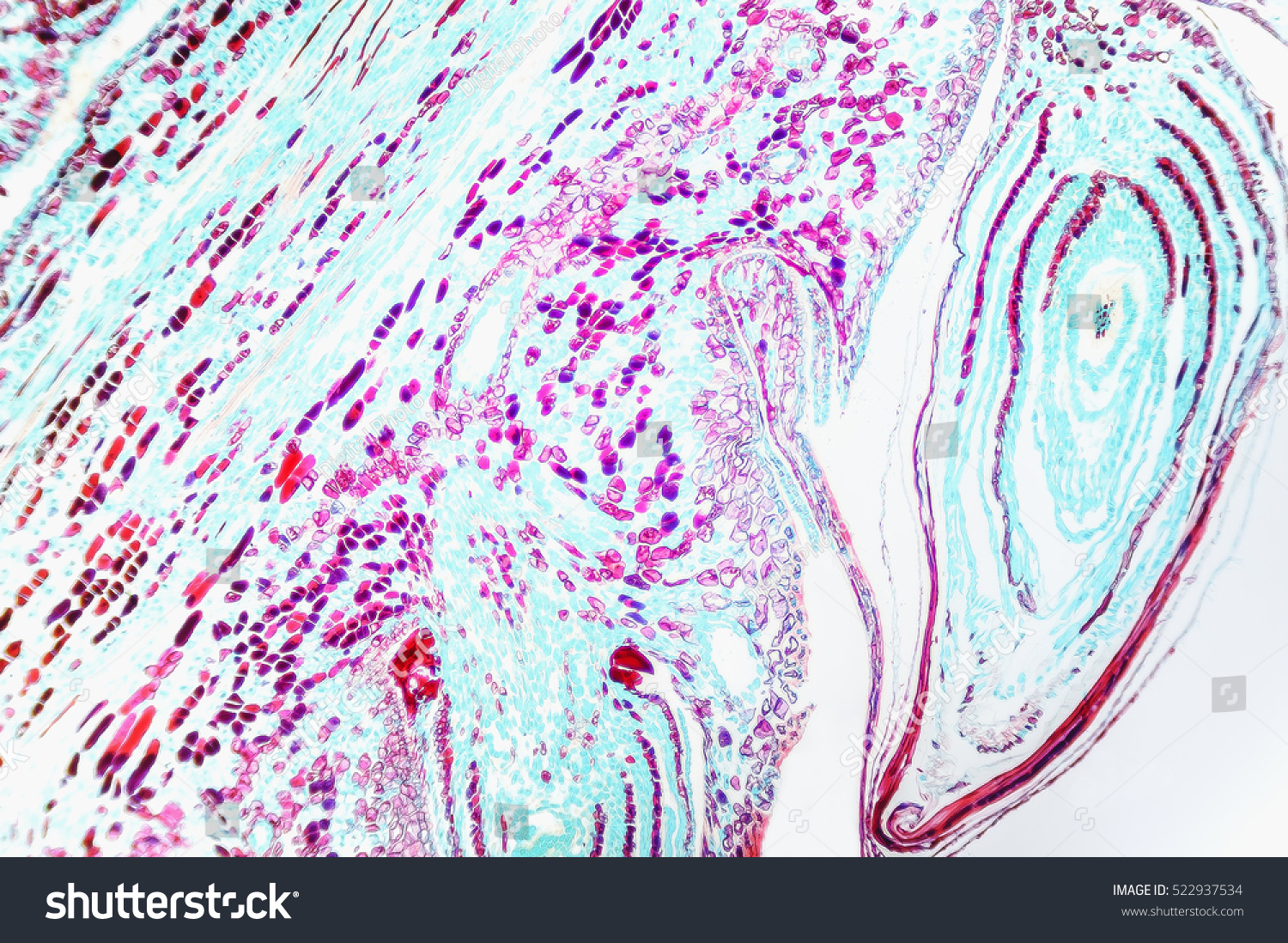 Reproductive Structures Pinus Female Strobile Micro Stock Photo ...