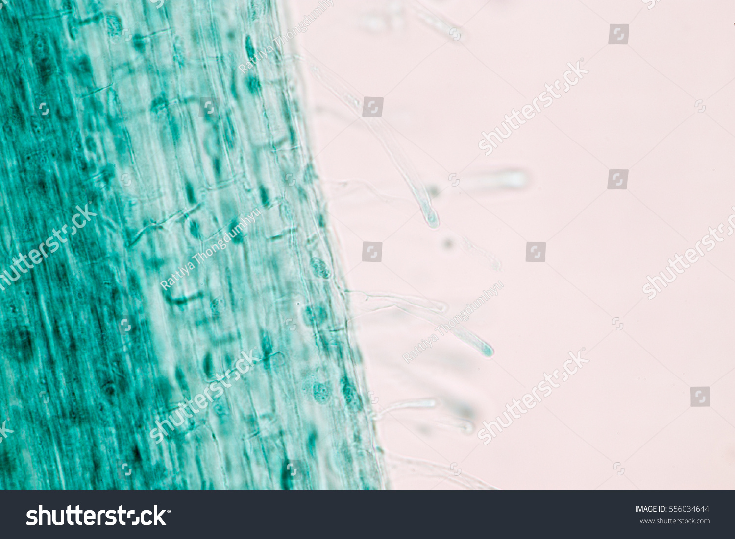 Root Hairs Cells Under Microscopic View Stock Photo Edit Now