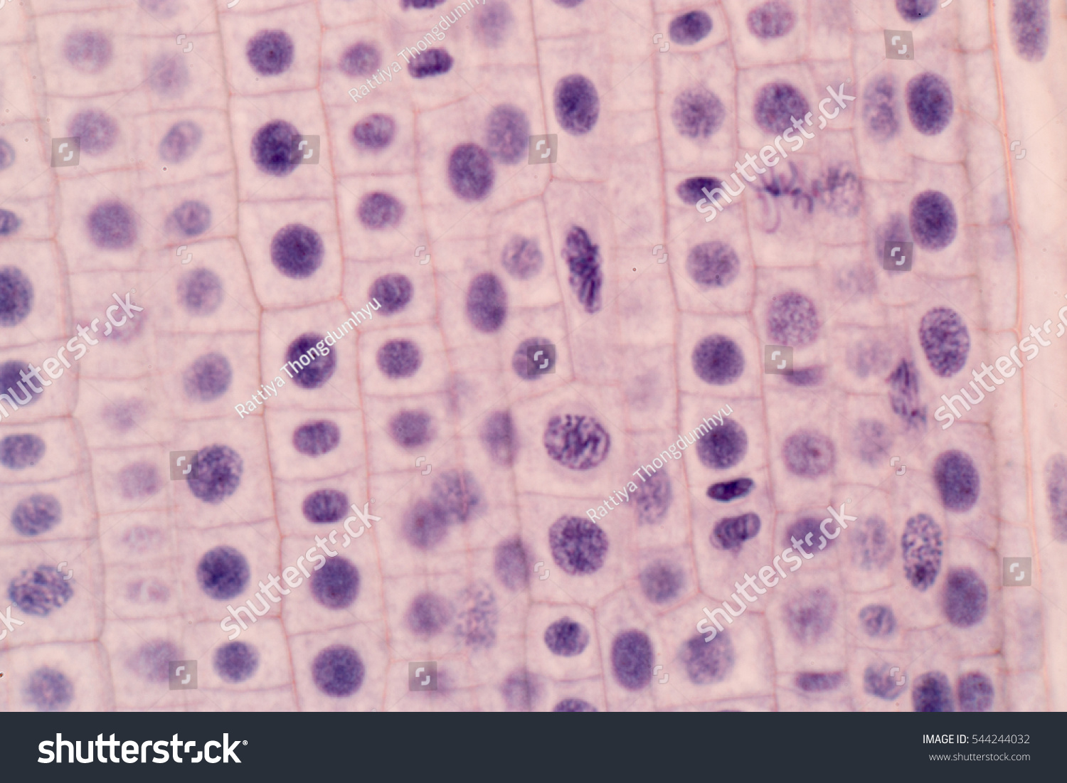 Root Tip Onion Mitosis Cell Root Stock Photo 544244032 | Shutterstock