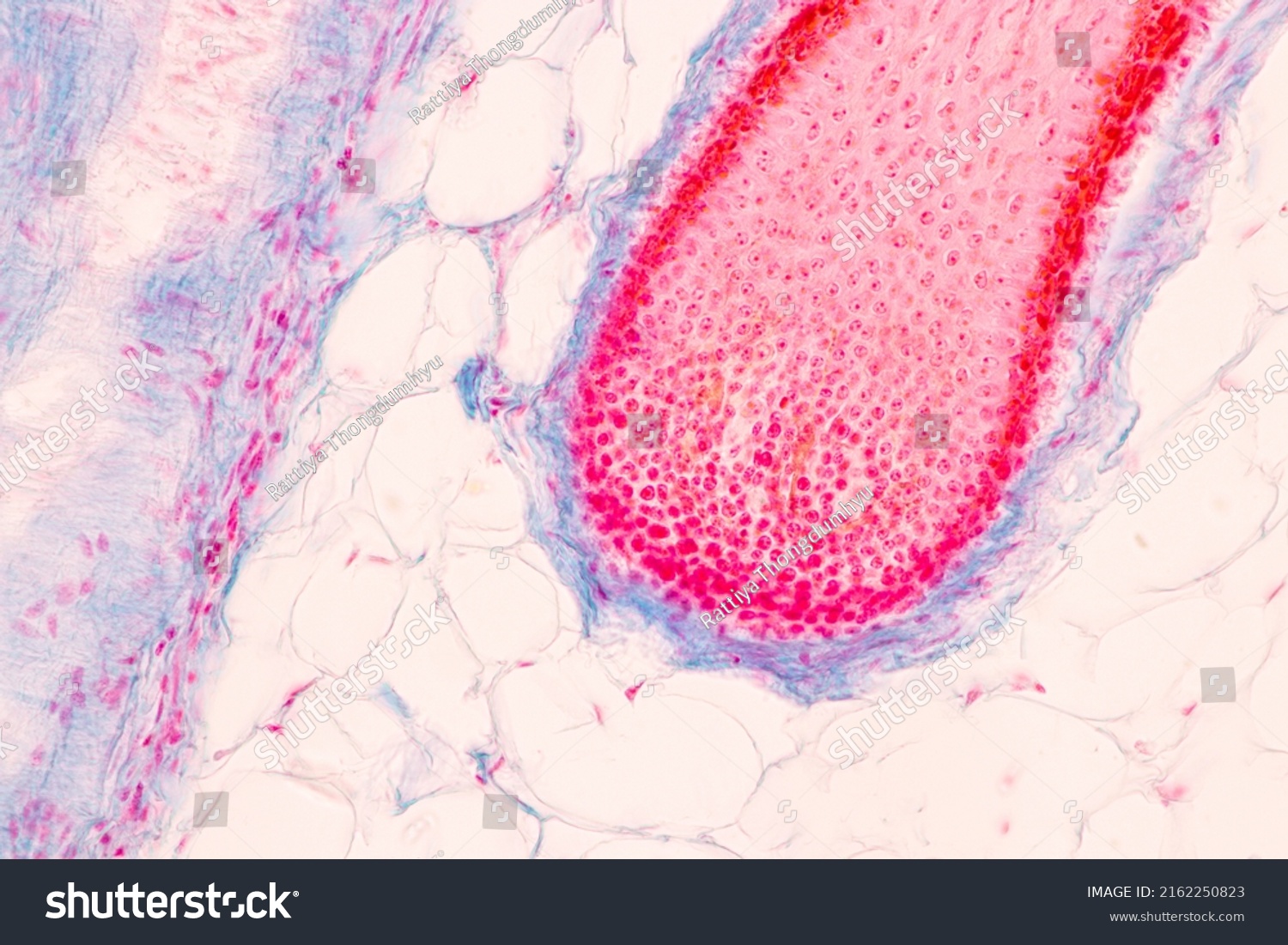 Scalp Hair Follicles Human Under Microscope Stock Photo 2162250823 