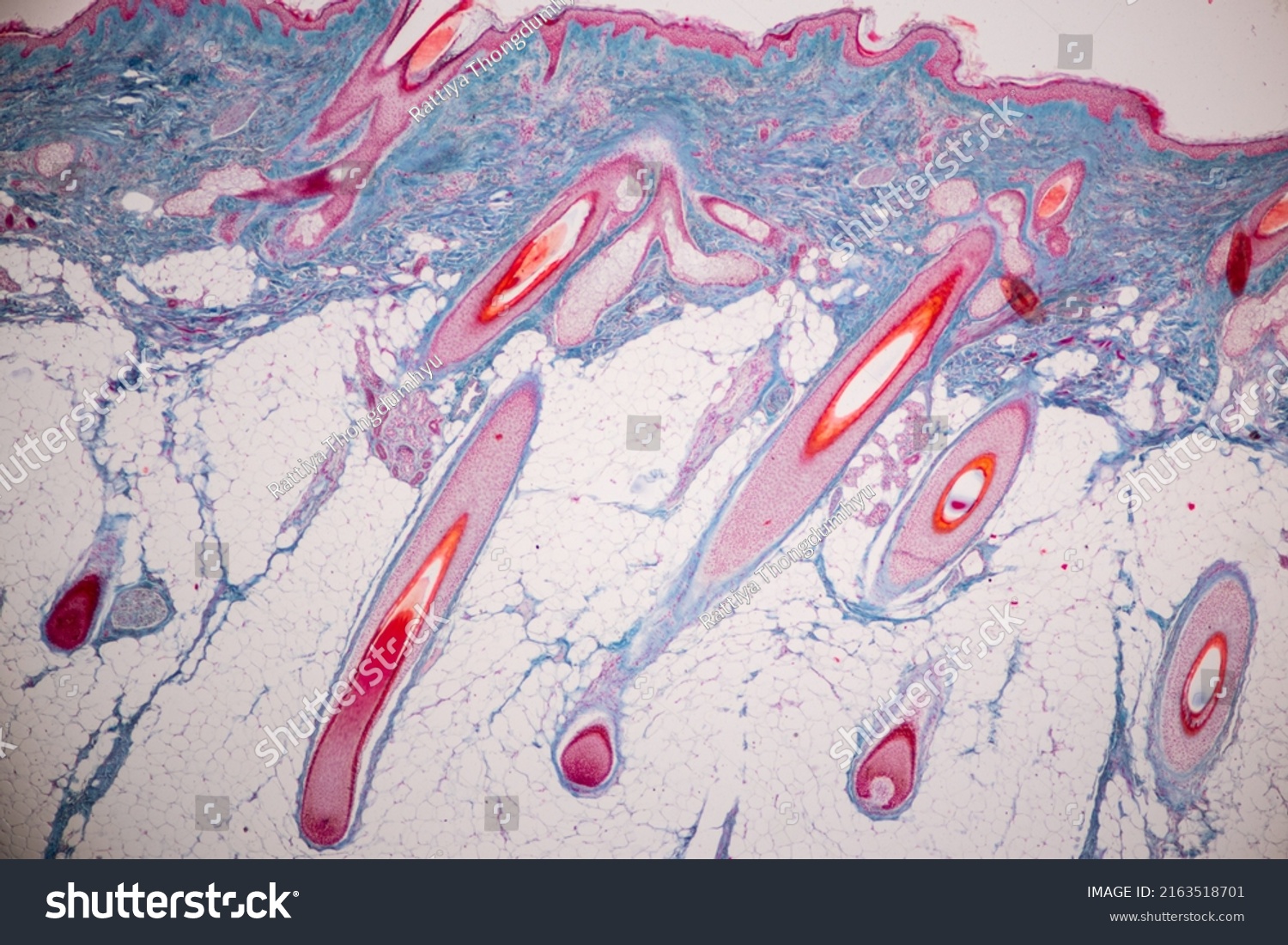 Scalp Hair Follicles Human Under Microscope Stock Photo 2163518701 ...