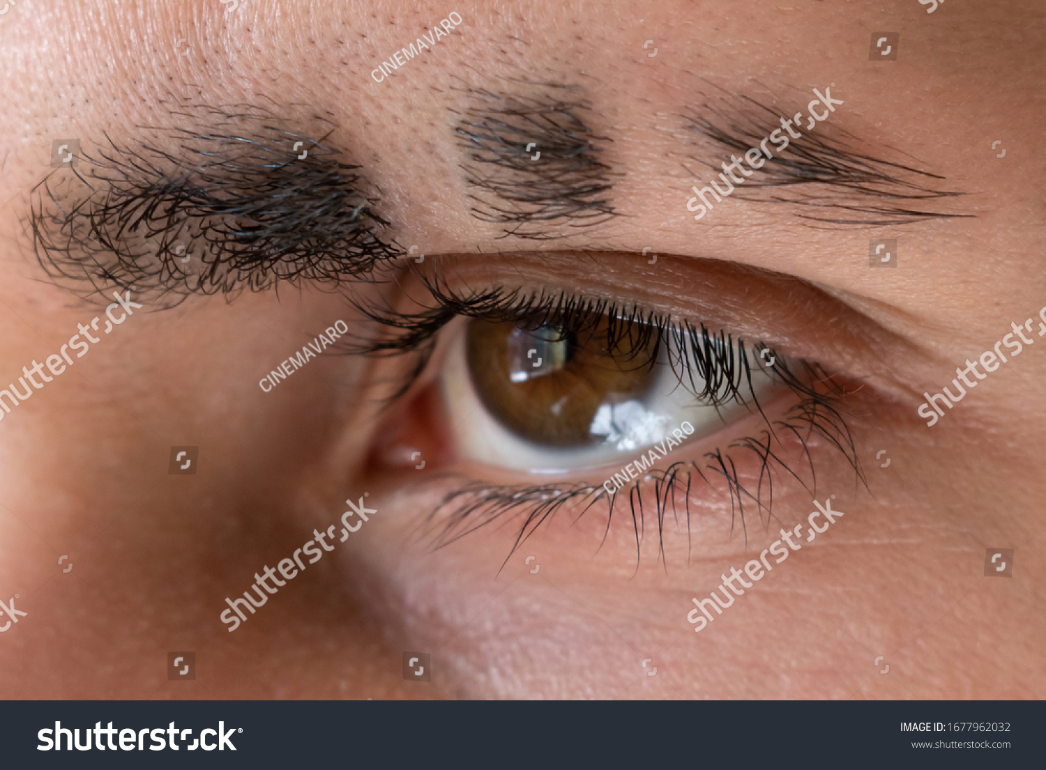 1,064 Eyebrow scar Images, Stock Photos & Vectors | Shutterstock