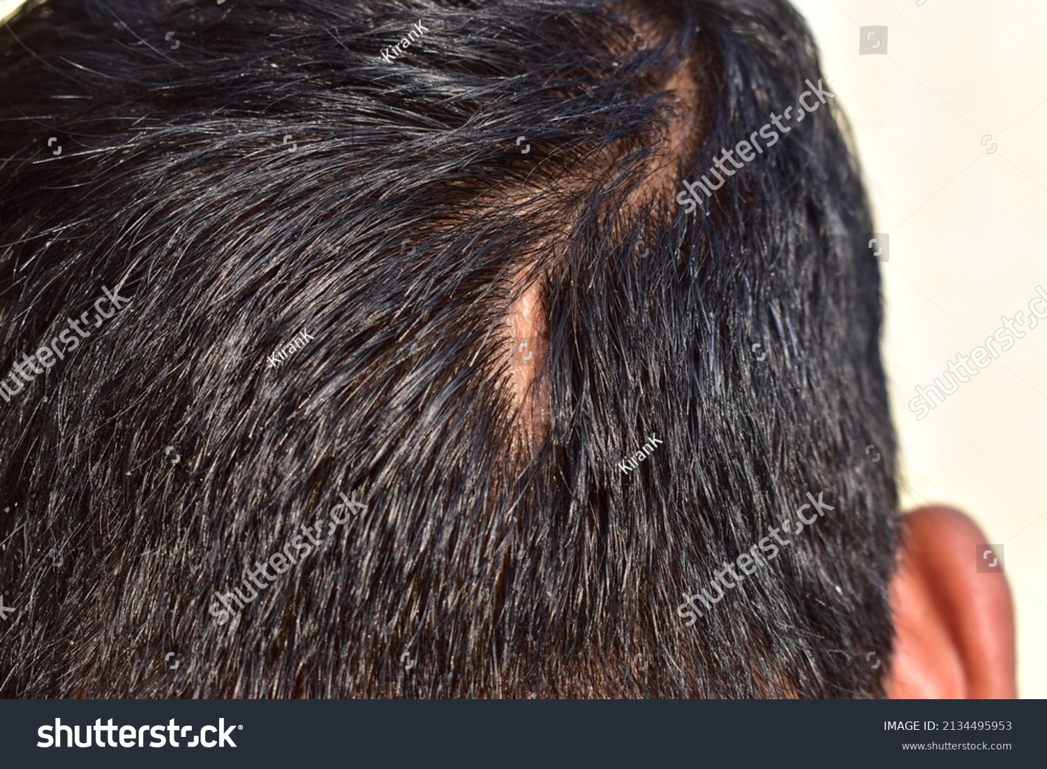 8,736 Scar head Images, Stock Photos & Vectors | Shutterstock