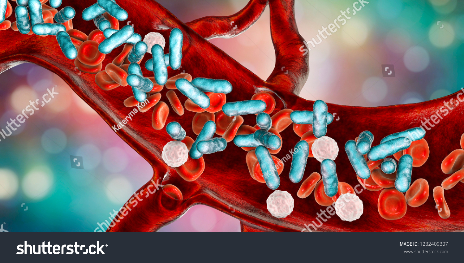 Sepsis, bacteria in blood. 3D illustration showing rod-shaped bacteria with red blood cells and leukocytes