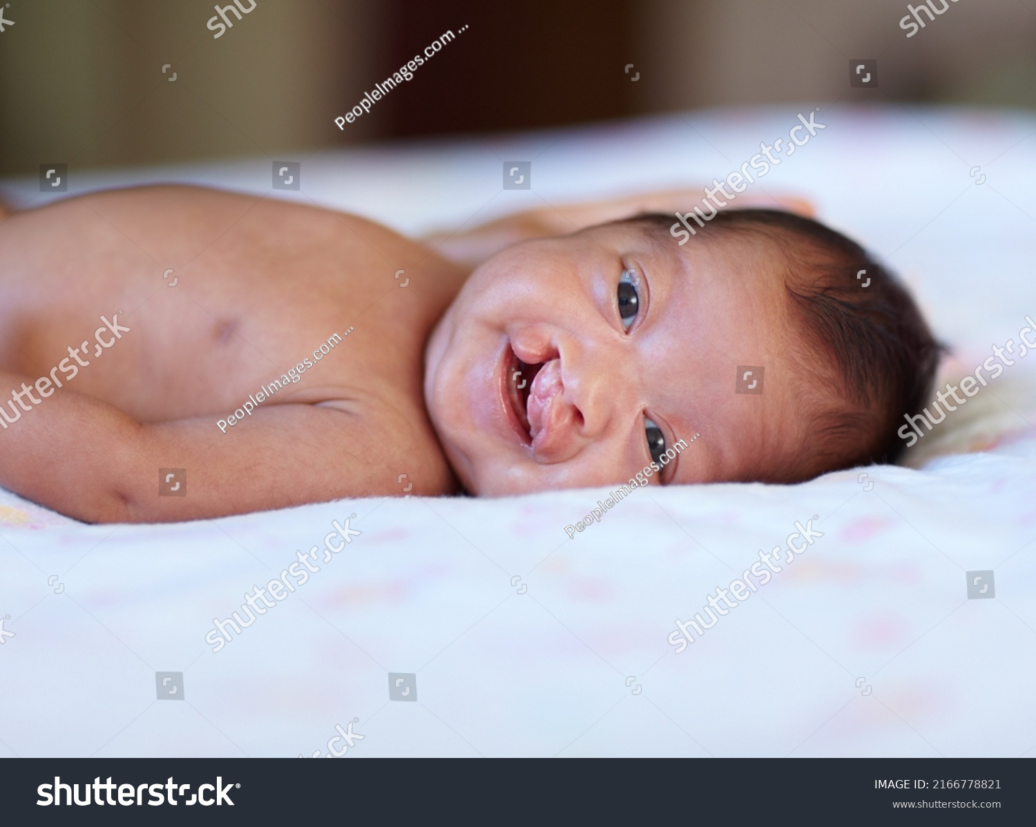 She Wont Let Her Birth Defect Stock Photo 2166778821 | Shutterstock