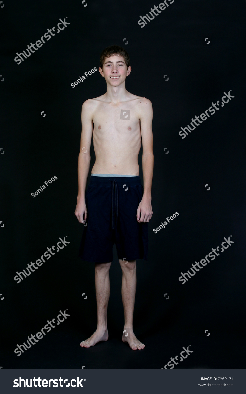 Skinny Boy Standing Wearing Shorts 