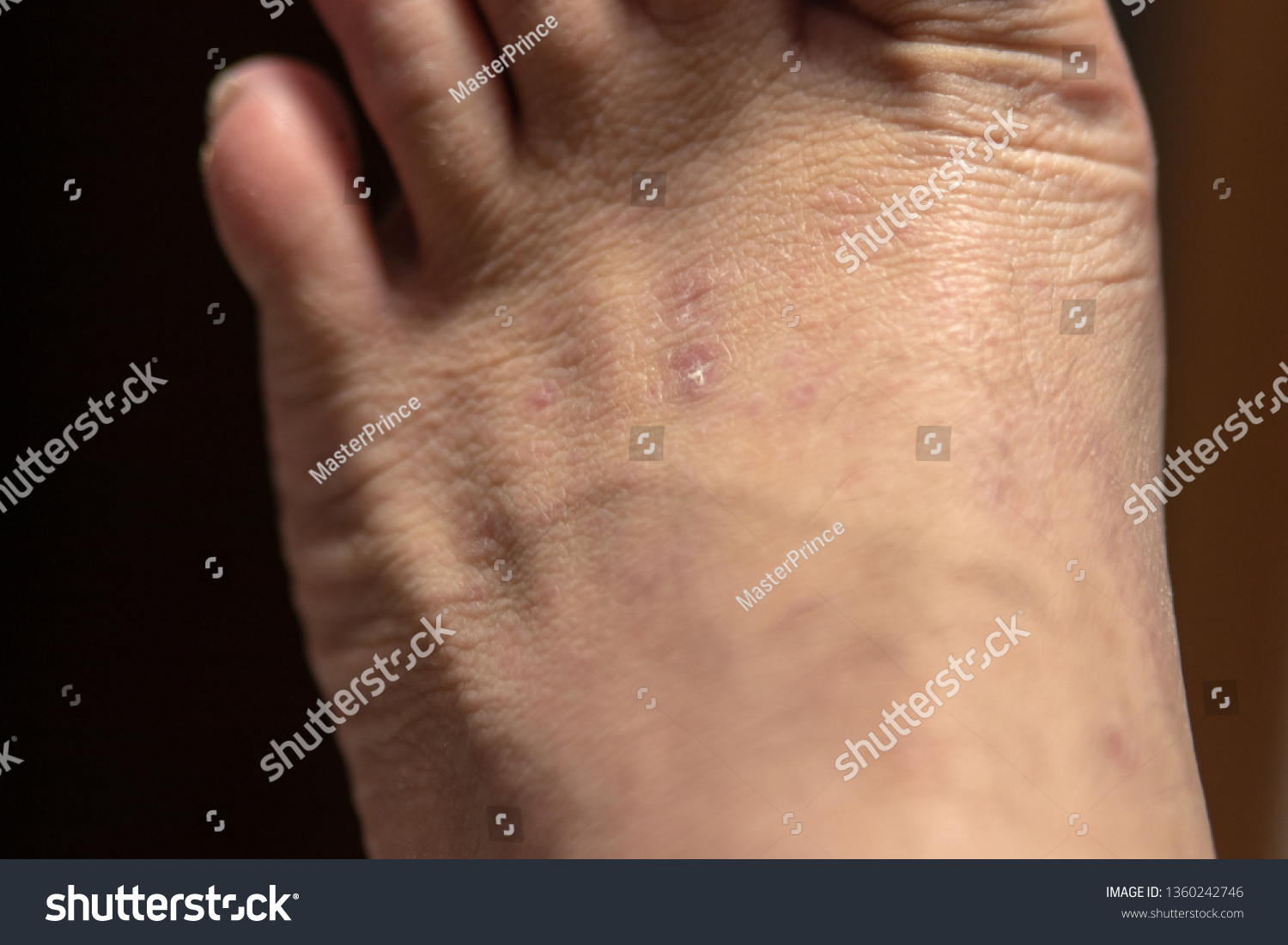 Small Blemished Top Foot Dry Skin Stock 