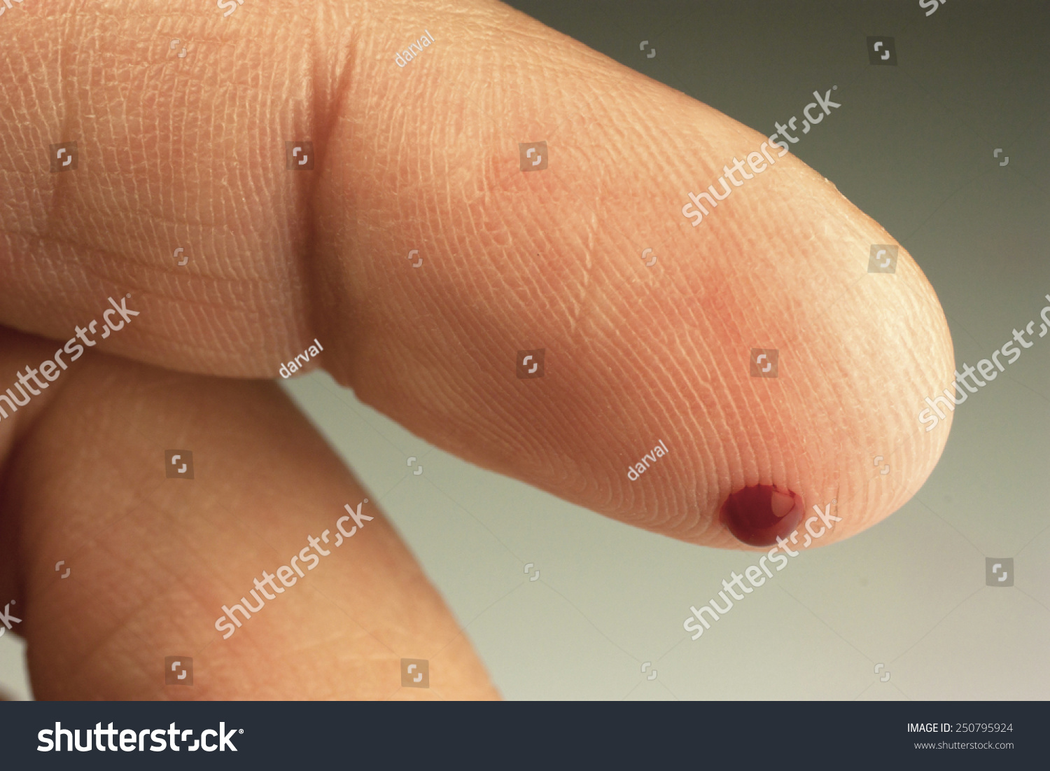 Small Drop Blood On Tip Finger Stock Photo Edit Now 250795924   Stock Photo Small Drop Of Blood On The Tip Of A Finger 250795924 