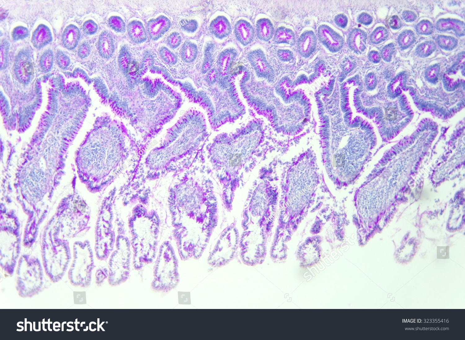 2,245 Histological sample Images, Stock Photos & Vectors | Shutterstock