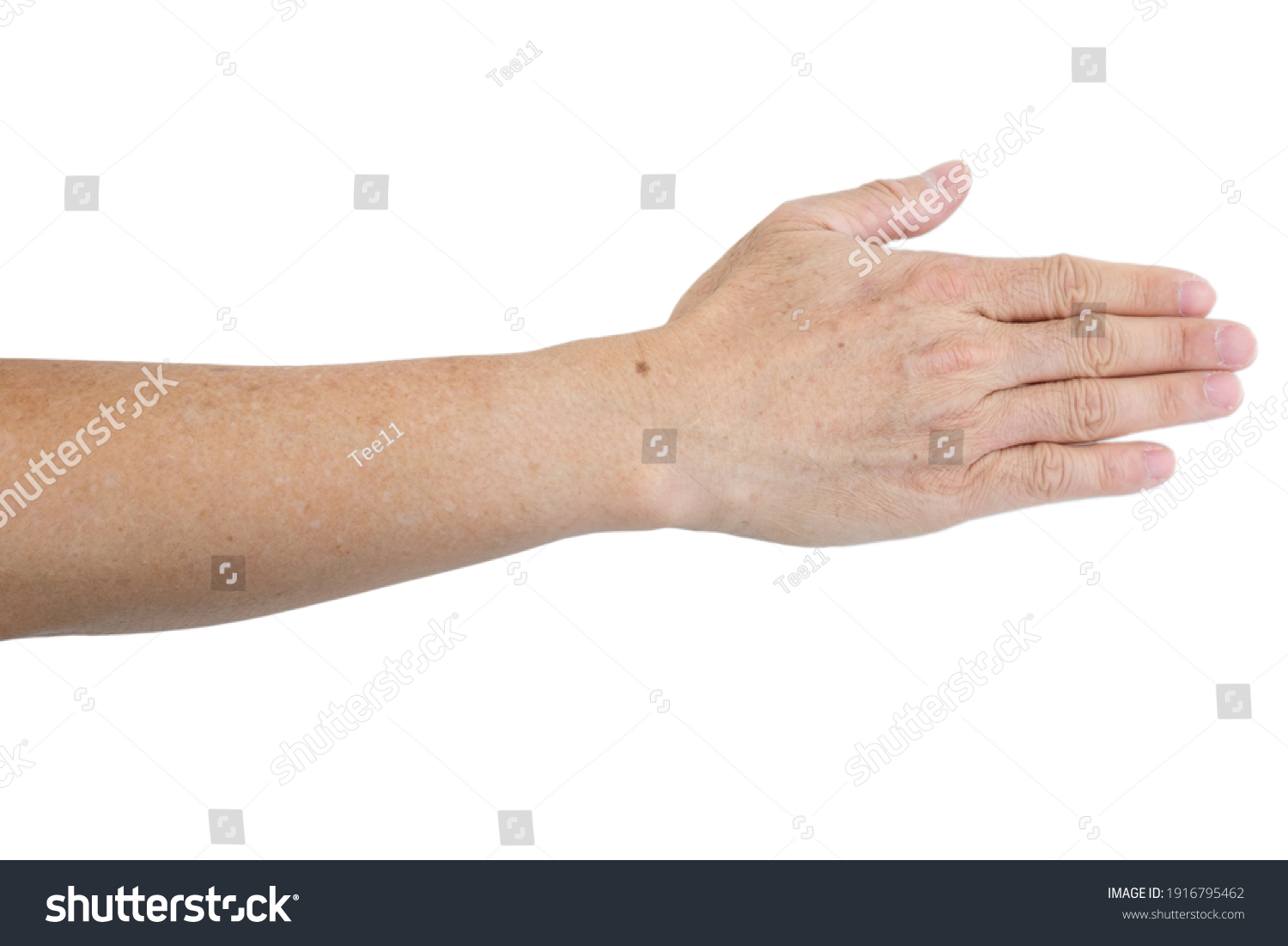 small-white-spots-on-arms-idiopathic-nh-c-s-n1916795462-shutterstock