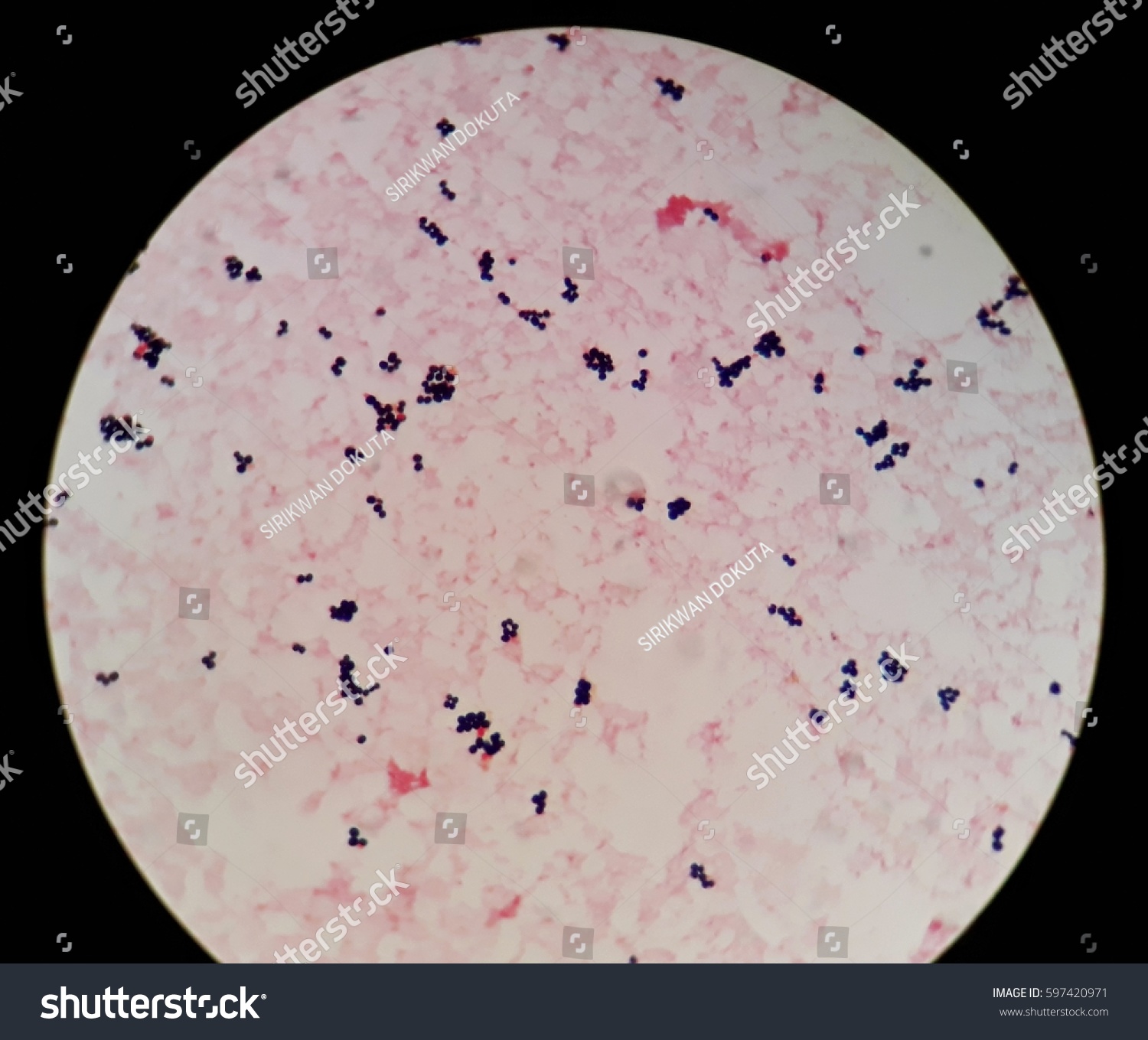 Smear Gram Positive Cocci Bacteria Under Stock Photo 597420971 ...