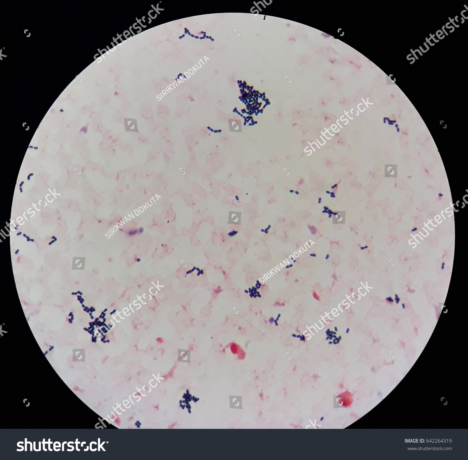 Smear Grams Stained Gram Positive Cocci Stock Photo (Edit Now) 642264319