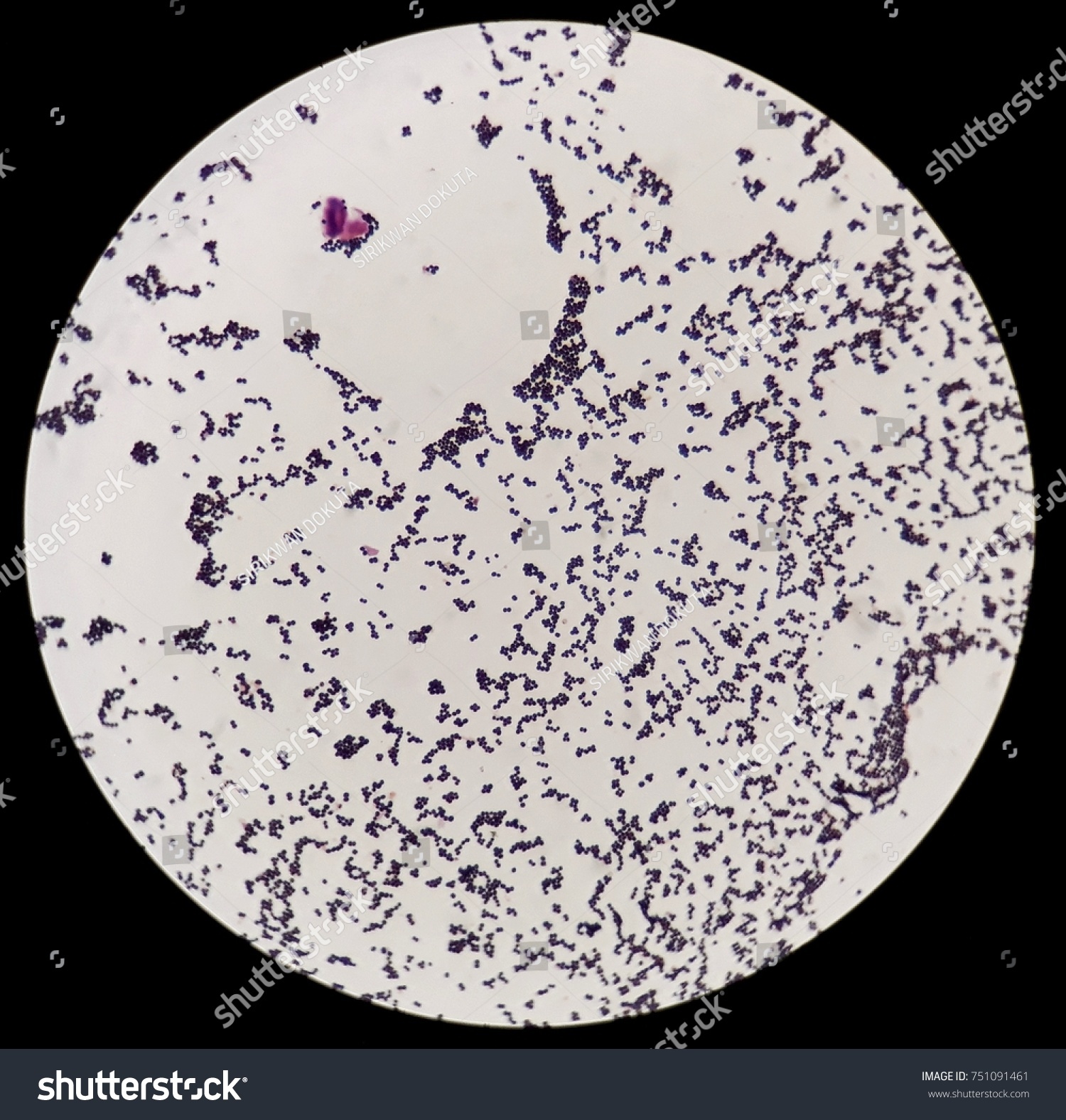 Smear Grams Stained Gram Positive Cocci Stock Photo 751091461 ...