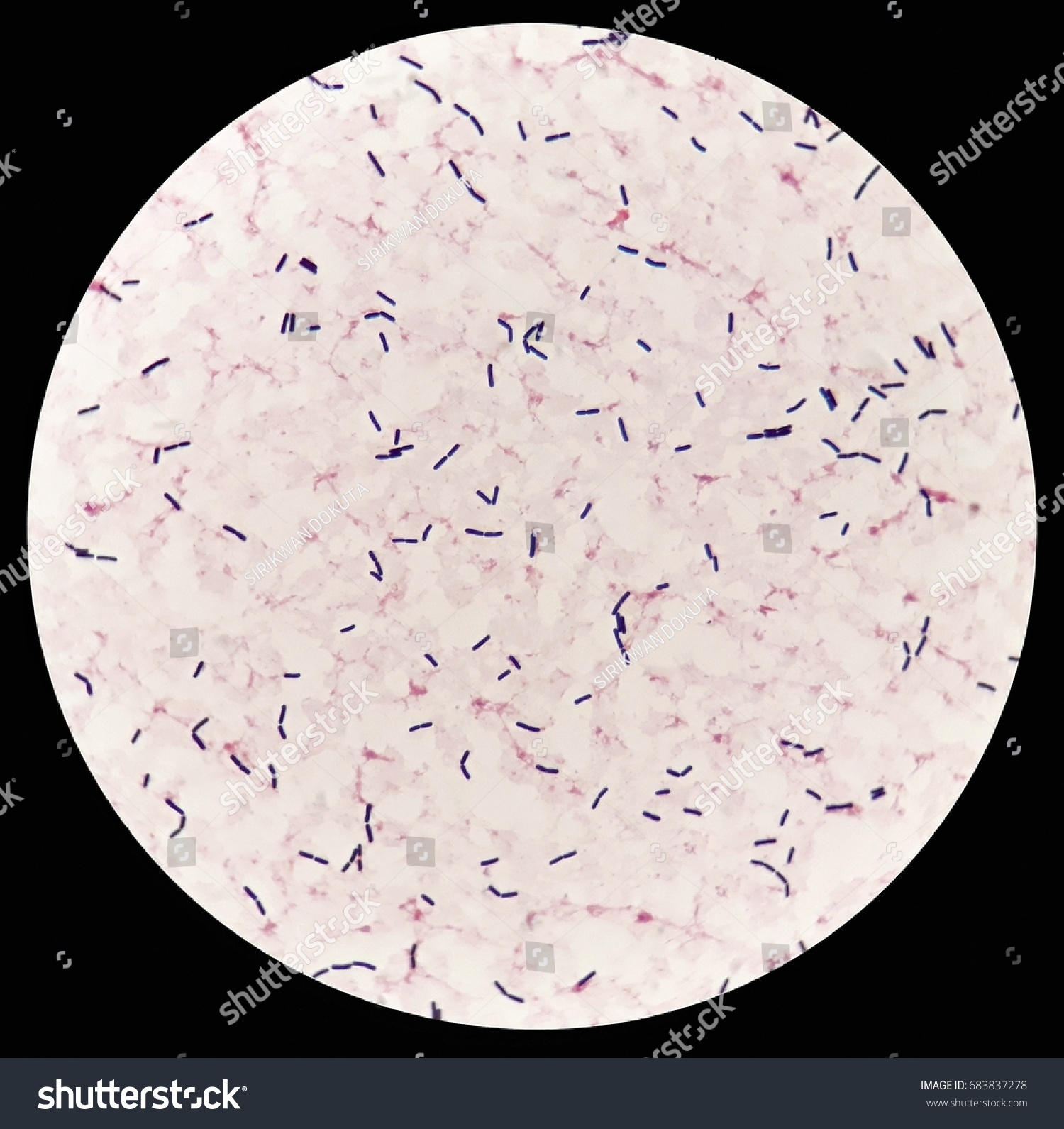 Smear Human Blood Culture Grams Stained Stock Photo 683837278 