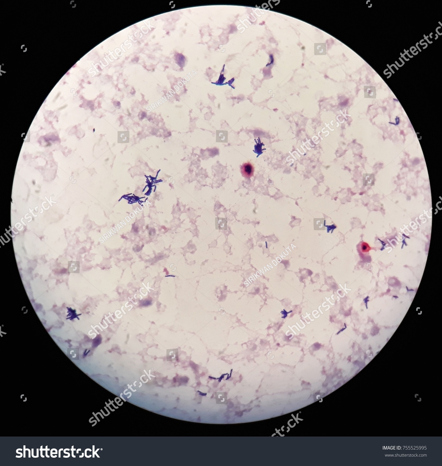 Smear Human Blood Culture Grams Stained Stock Photo 755525995 ...