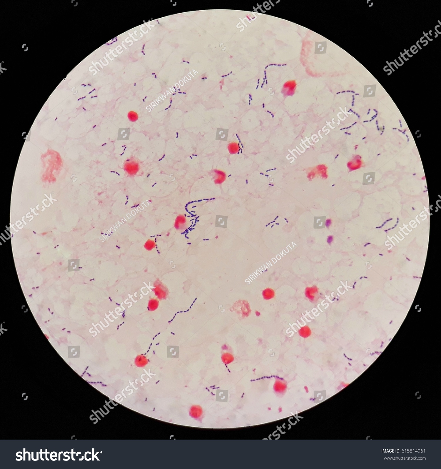 Gram Positive Cocci Blood Culture