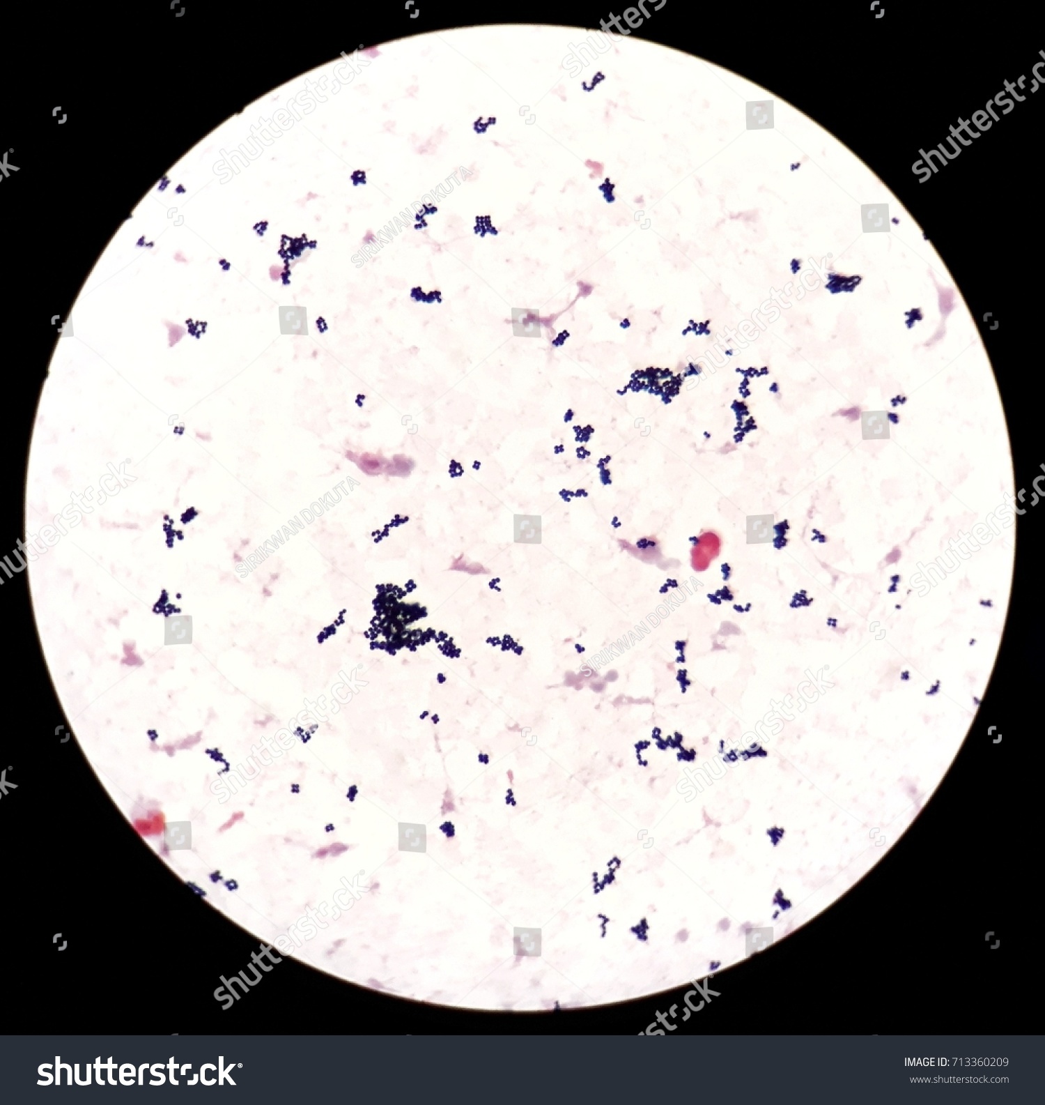 Smear Human Blood Culture Grams Stained Stock Photo (Edit Now) 713360209