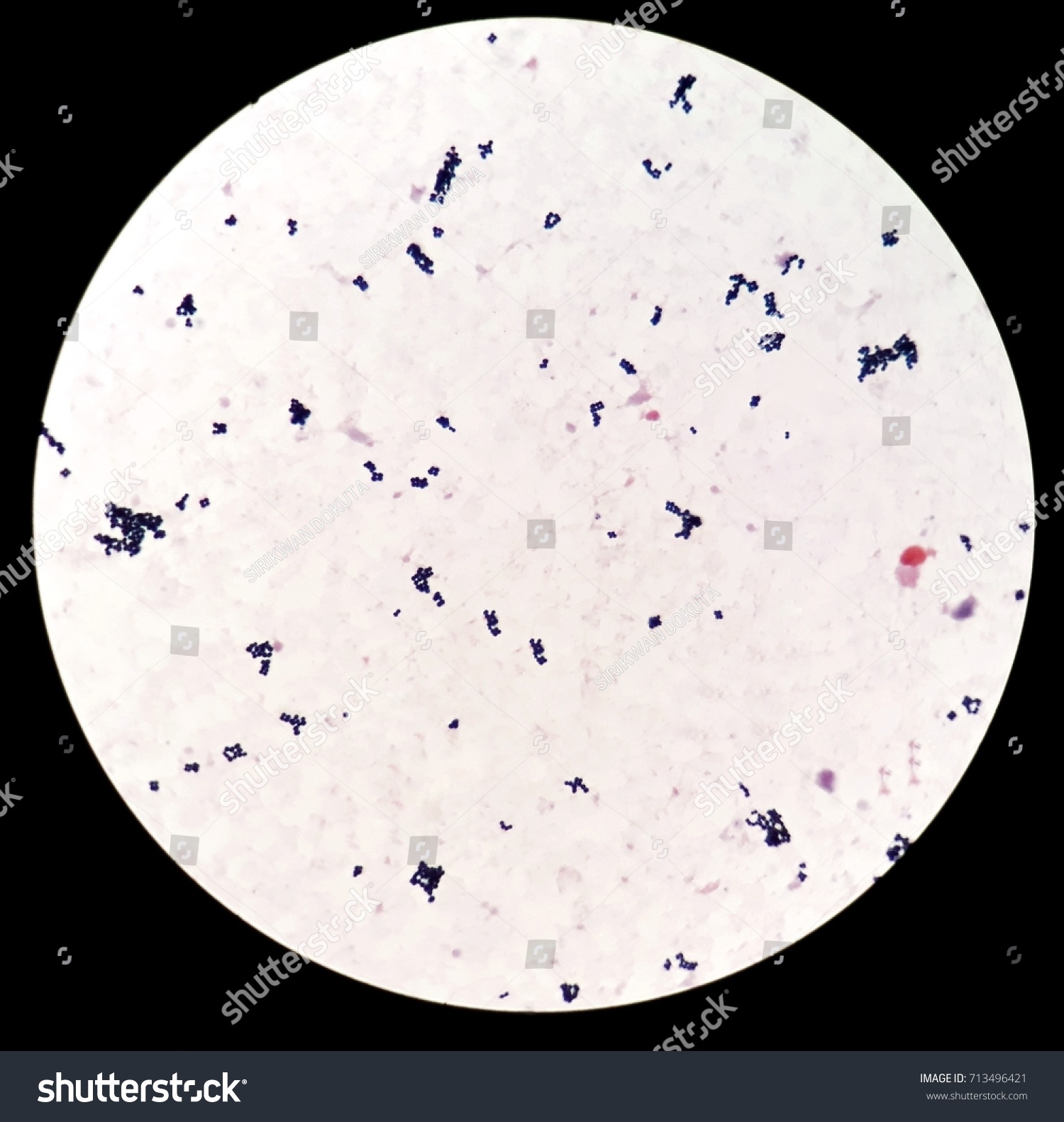 Smear Human Blood Culture Grams Stained Stock Photo (Edit Now) 713496421