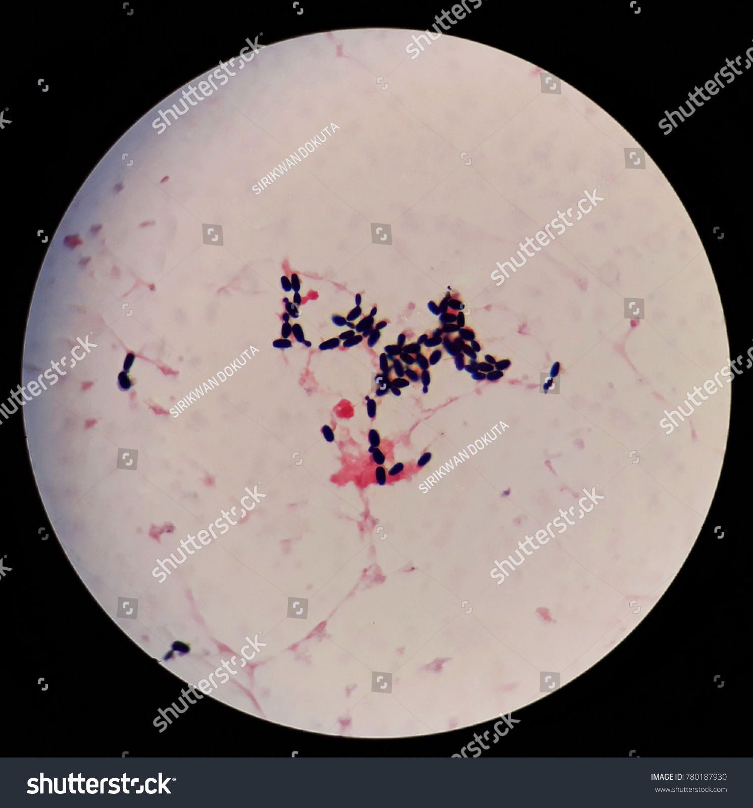 Smear Human Blood Cultured Grams Stained Stock Photo (Edit Now) 780187930