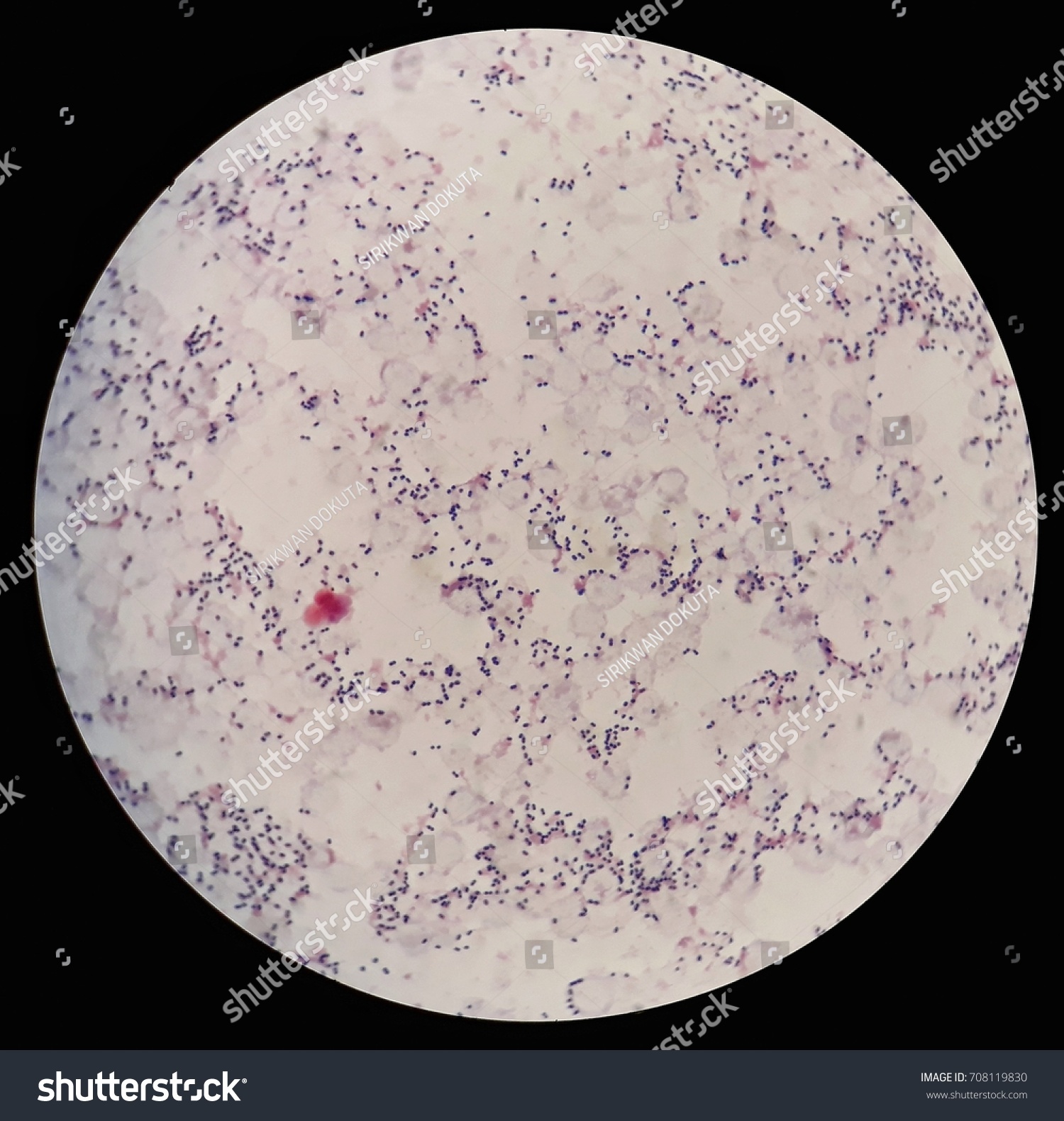 Smear Human Blood Cultured Grams Stained Stock Photo (Edit Now) 708119830