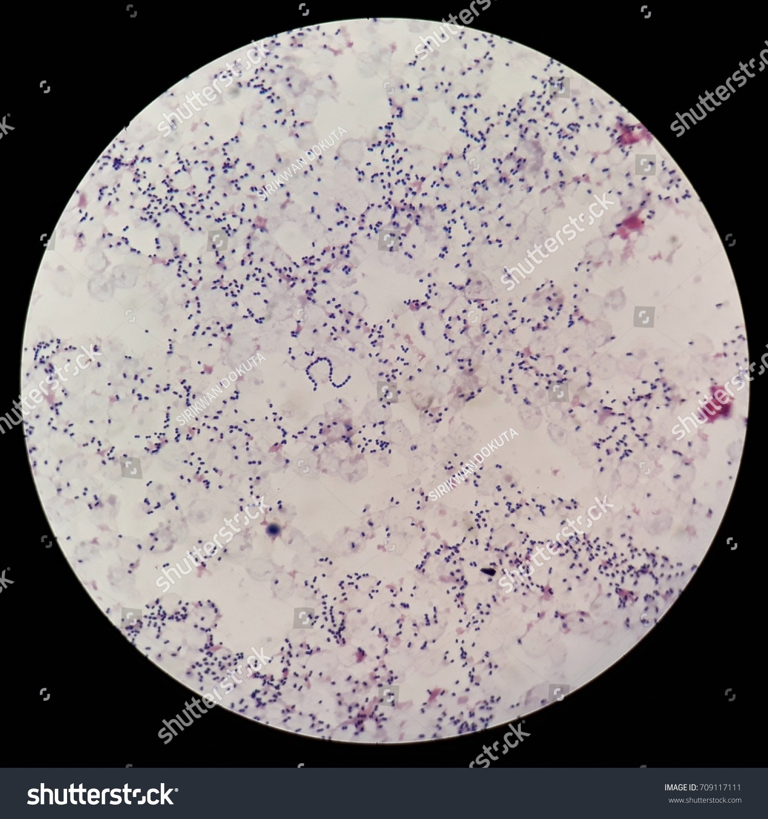 Smear Human Blood Cultured Grams Stained Stock Photo 709117111 ...