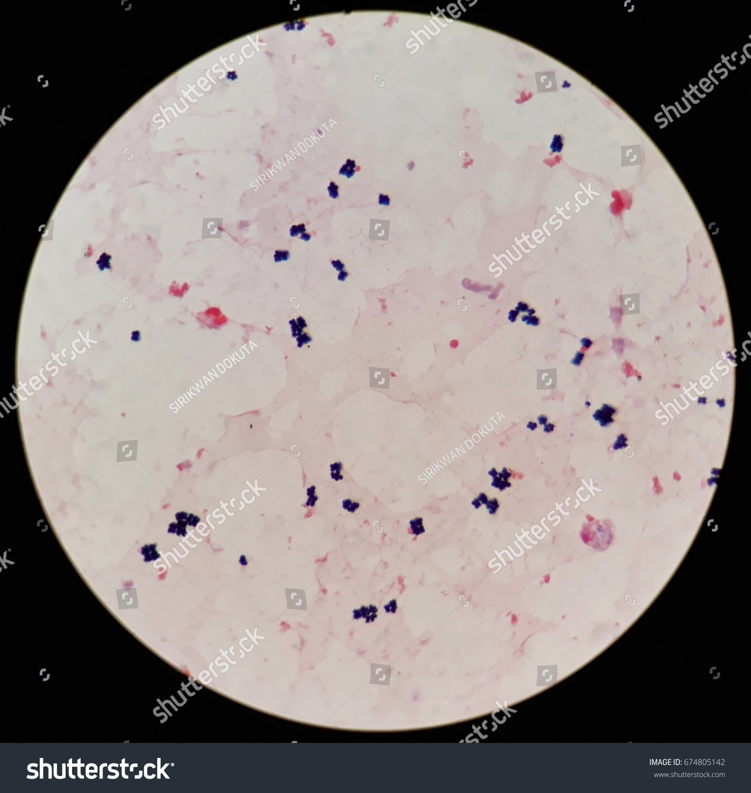 Smear Human Blood Cultured Grams Stained Stock Photo 674805142 ...