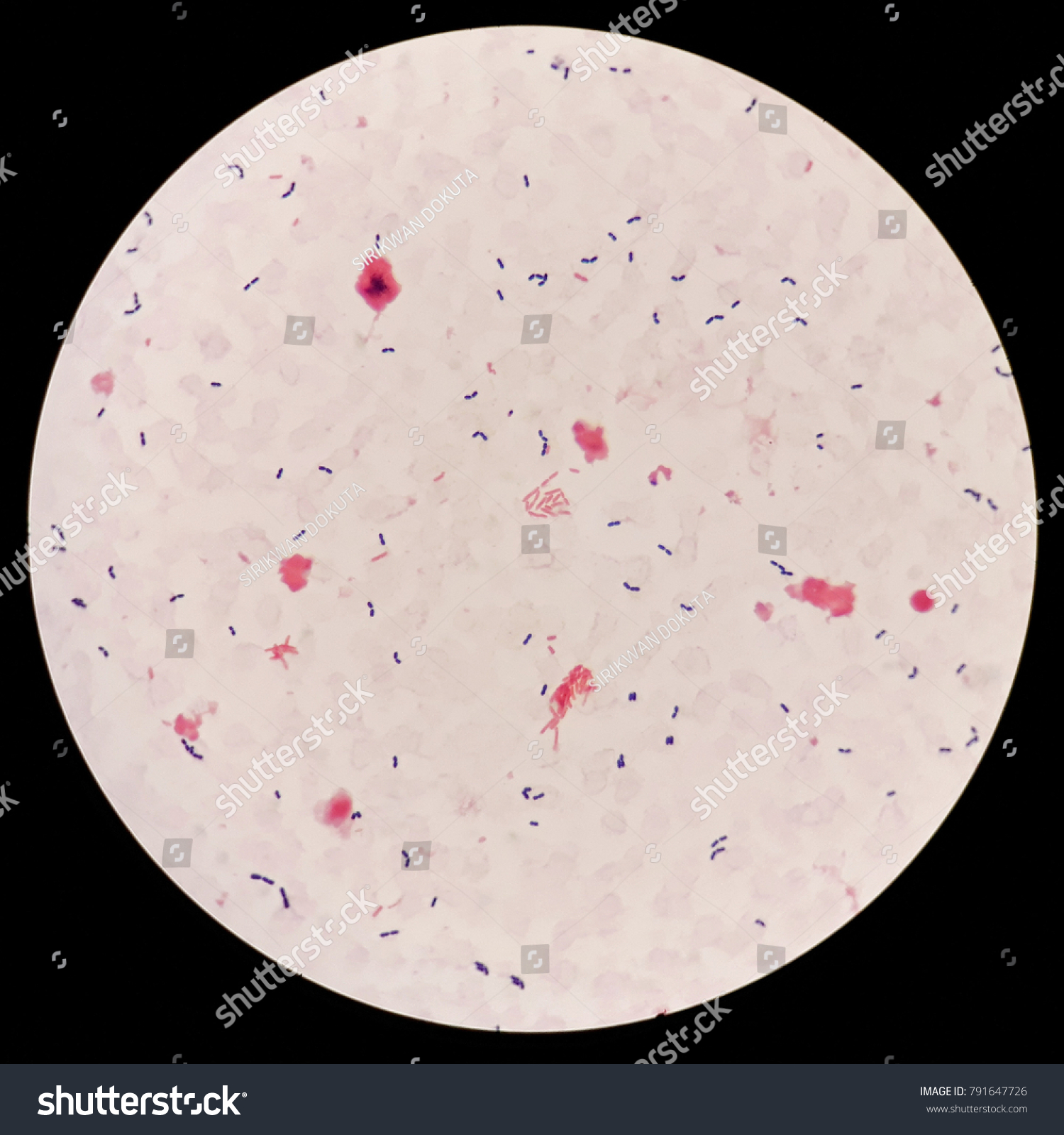 Smear Human Blood Cultured Specimen Gram Stock Photo (Edit Now) 791647726