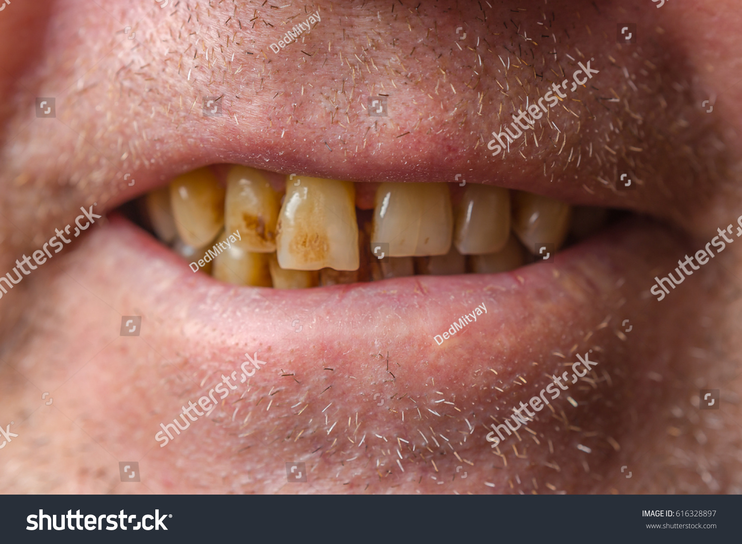 dating someone with crooked teeth My super cute and indie friend shirls actively seeks out people with crooked teeth because she says people with i could go on a date someone with bad teeth. dating someone with crooked teeth My super cute and indie friend shirls actively seeks out people with crooked teeth because she says people with i could go on a date someone with bad teeth.