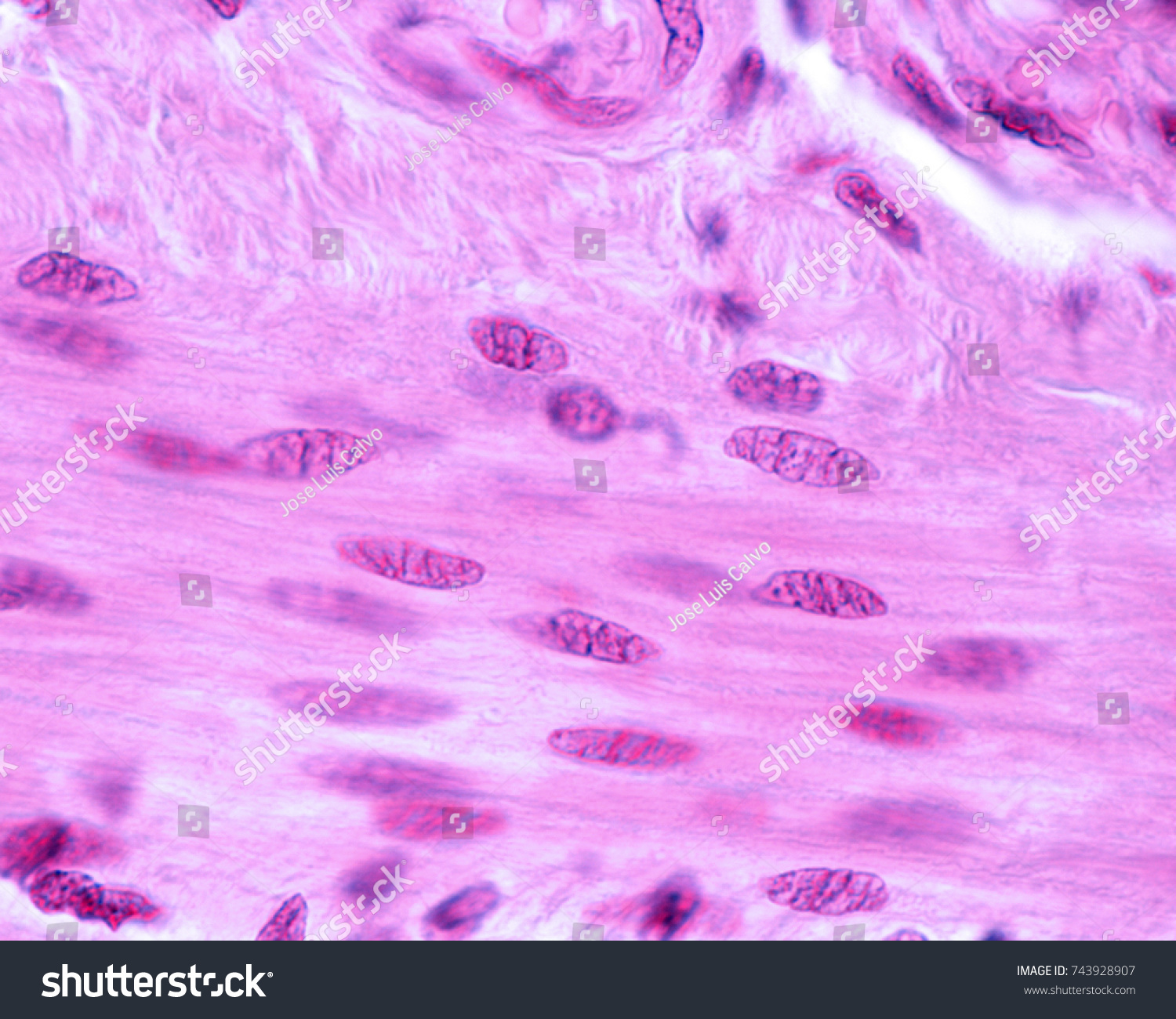 Smooth Muscle Fibers Wall Small Intestine Stock Photo (Edit Now) 743928907