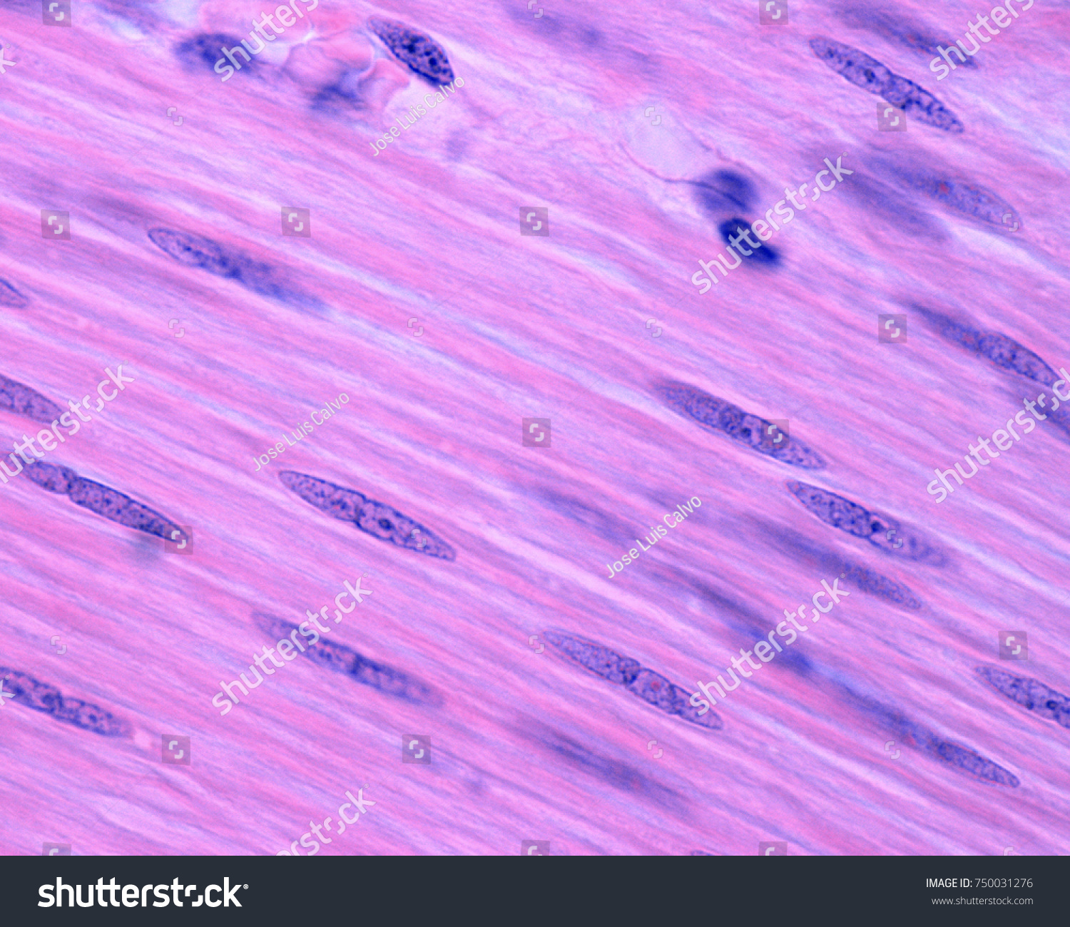 smooth-muscle-tissue-images-photos-et-images-vectorielles-de-stock