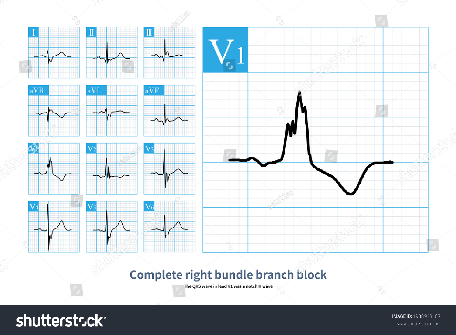 21 Notch t wave Images, Stock Photos & Vectors | Shutterstock