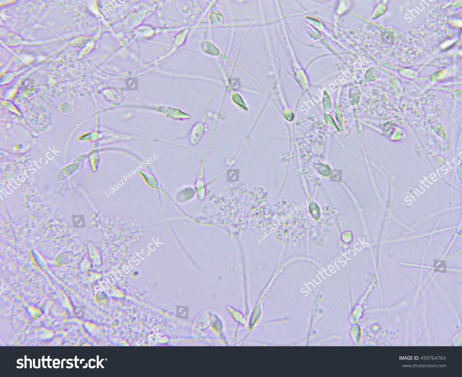 Sperm Microscopic View Stock Photo 459764764 - Shutterstock