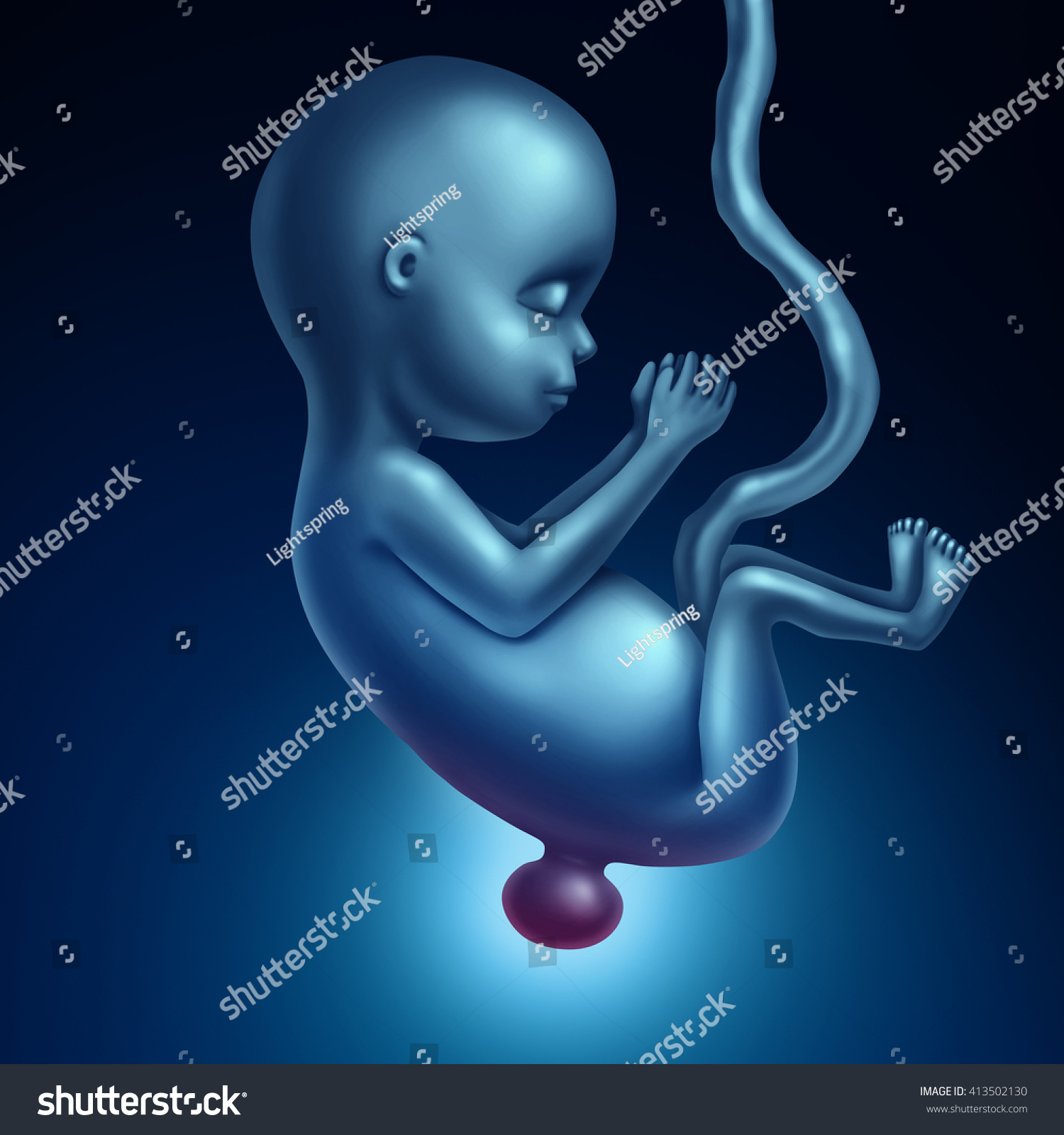 Spina Bifida Birth Defect Medical Concept Illustration De Stock