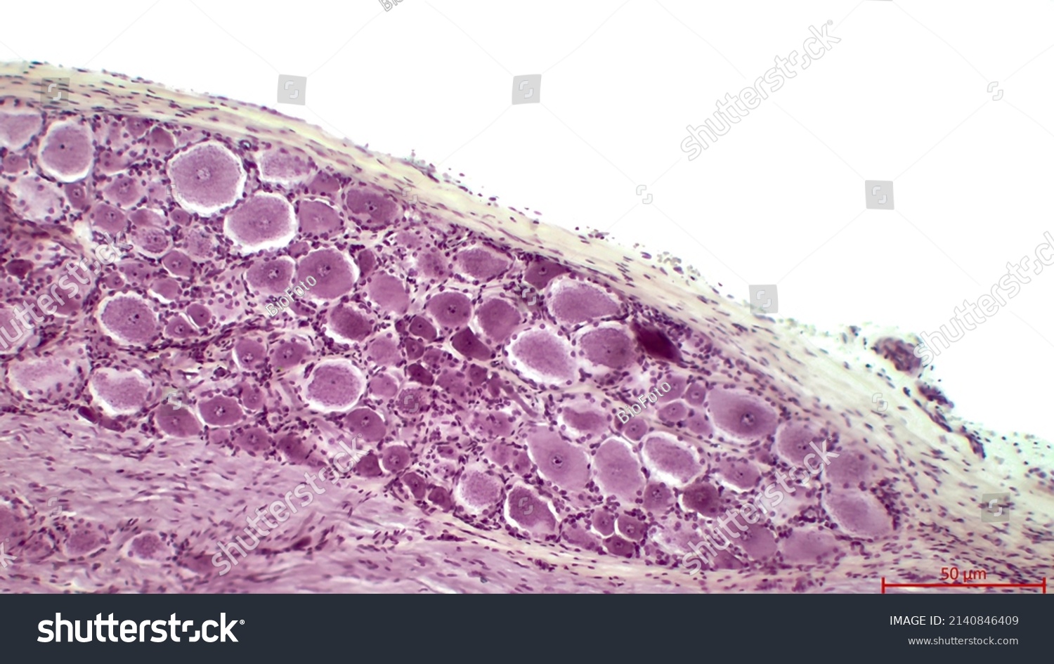 Spinal Nerve Ganglion Light Micrograph Section Stock Photo 2140846409 ...