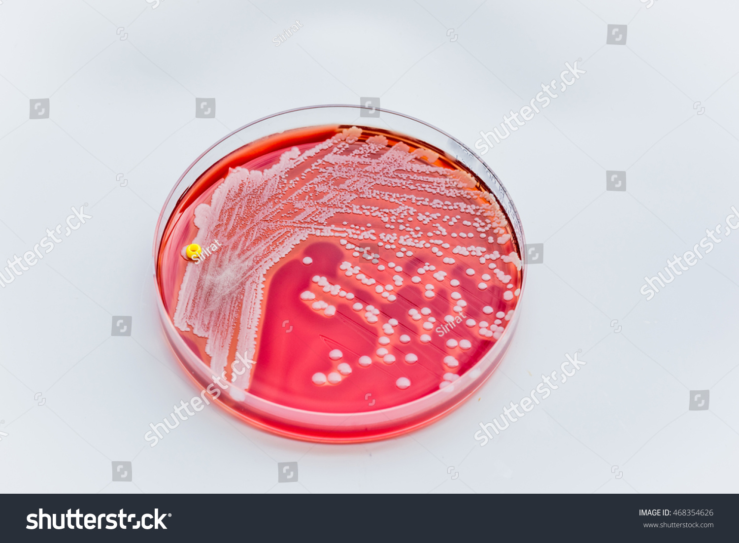 Staphylococcus Aureus Grampositive Gramvariable Nonmotile Coccusbeta ...