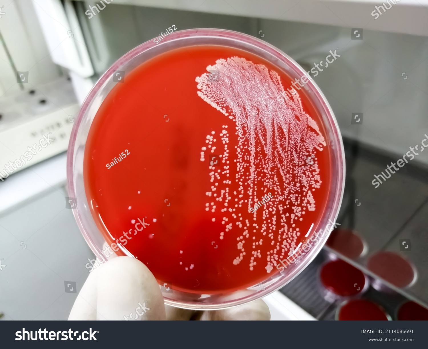 Staphylococcus Aureus Grampositive Gramvariable Nonmotile Coccus Stock ...