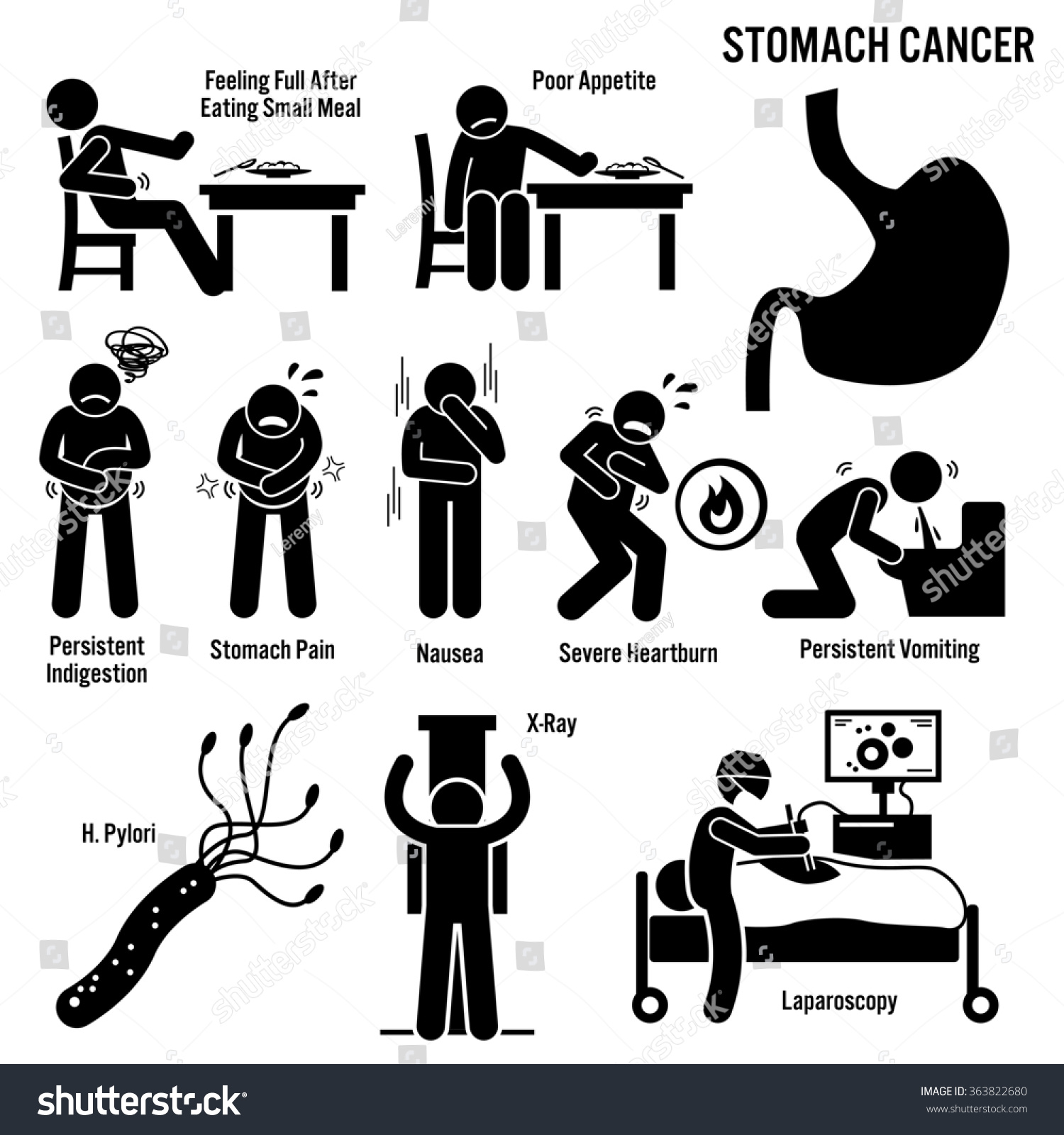 stomach cancer symptoms 