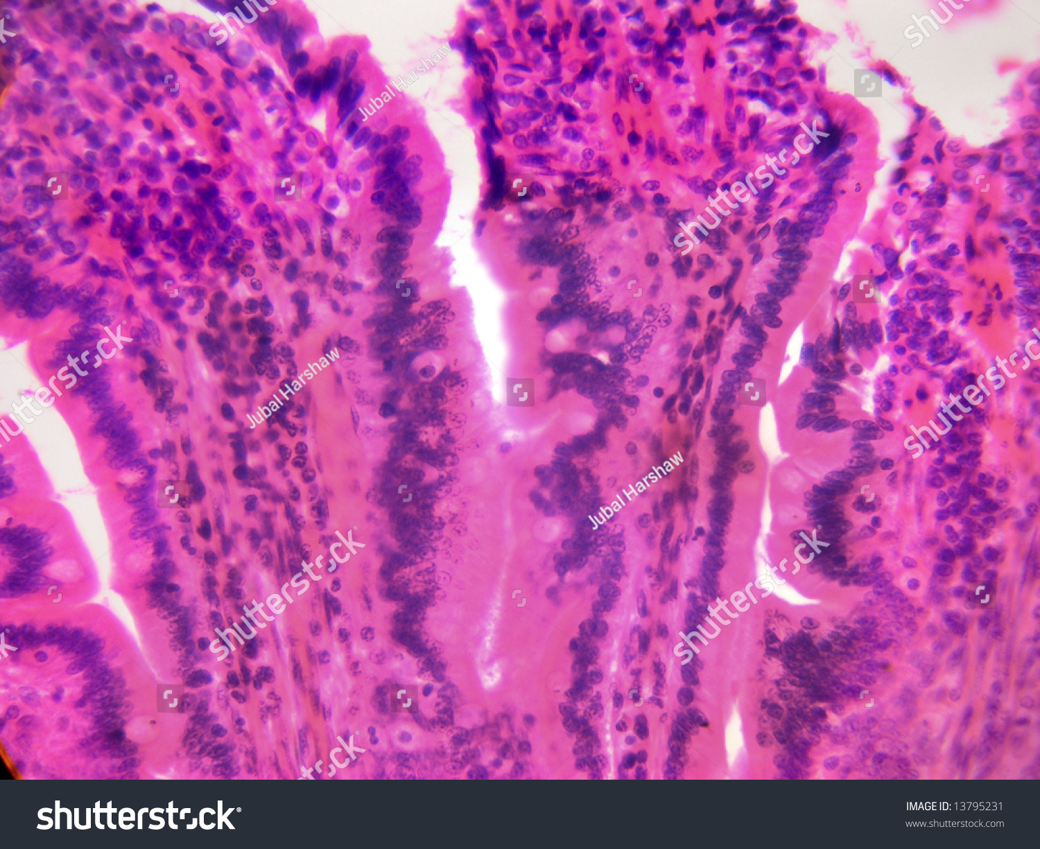 Stomach Tissue Microscopic High Power Stock Photo 13795231 - Shutterstock